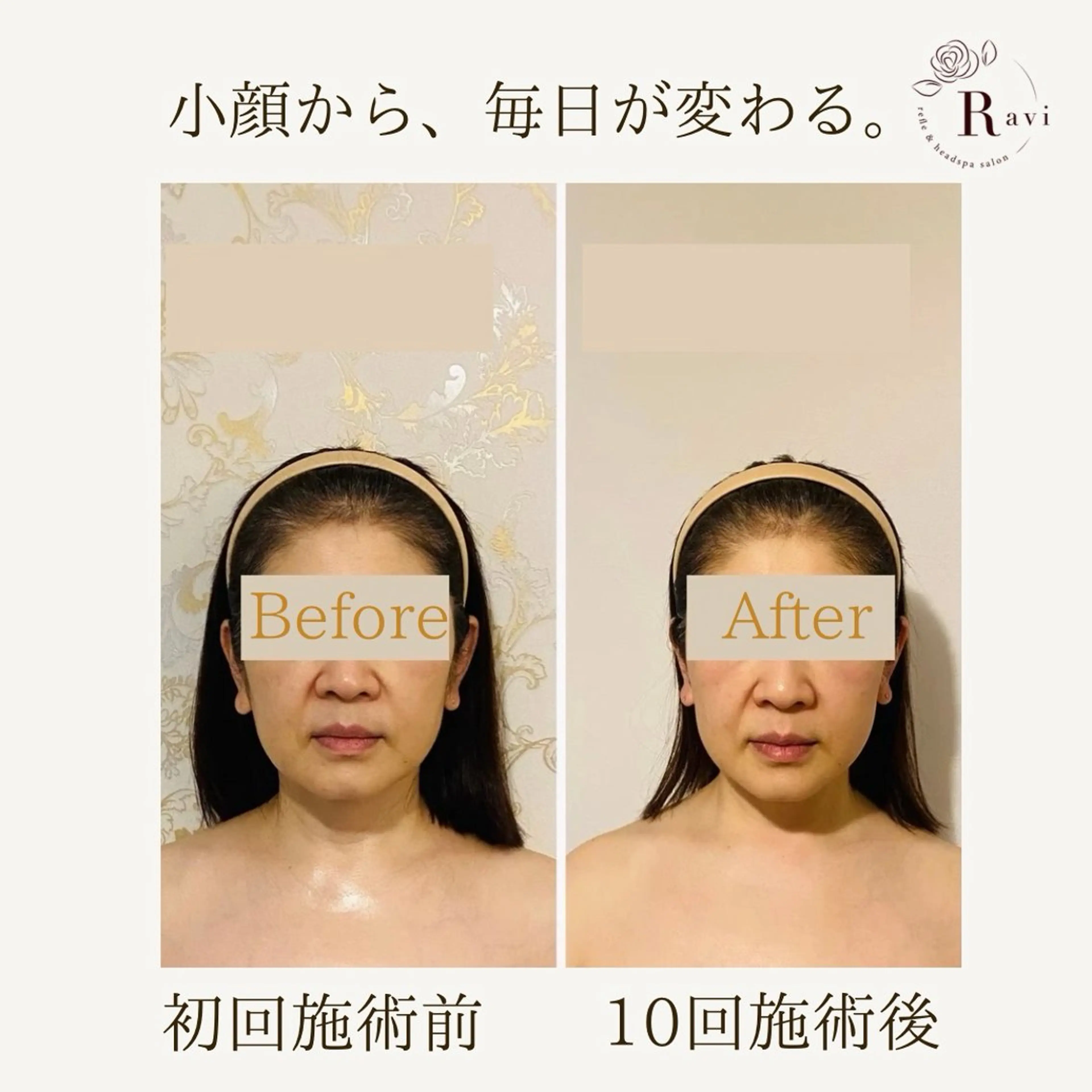 小顔サロンラヴィ　　船橋馬込沢店所属・小顔サロンラヴィ 船橋のエステ・リラクイメージ