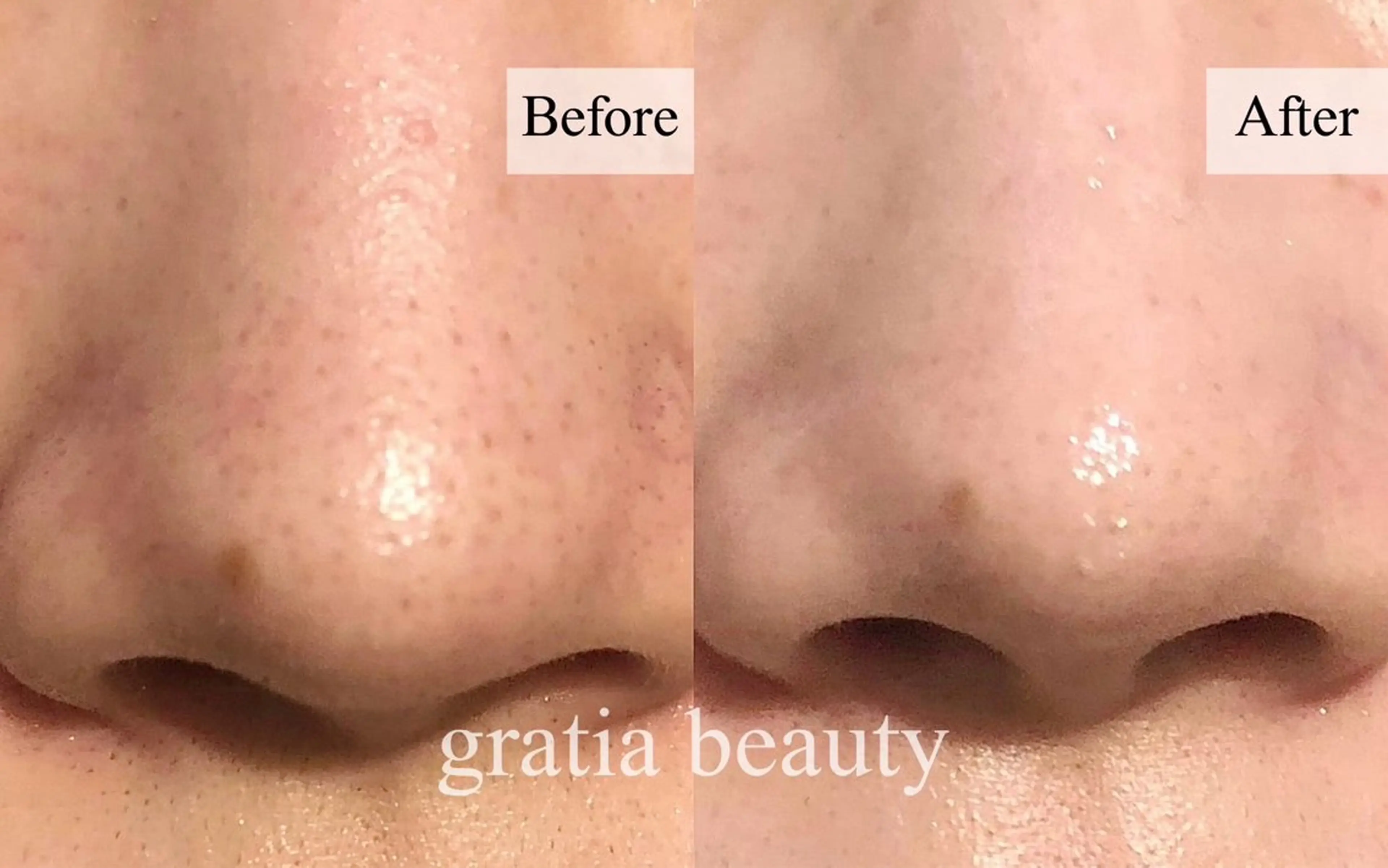 エステ gratia eyelash･nail･beauty所属・gratia salonのエステ・リラクイメージ