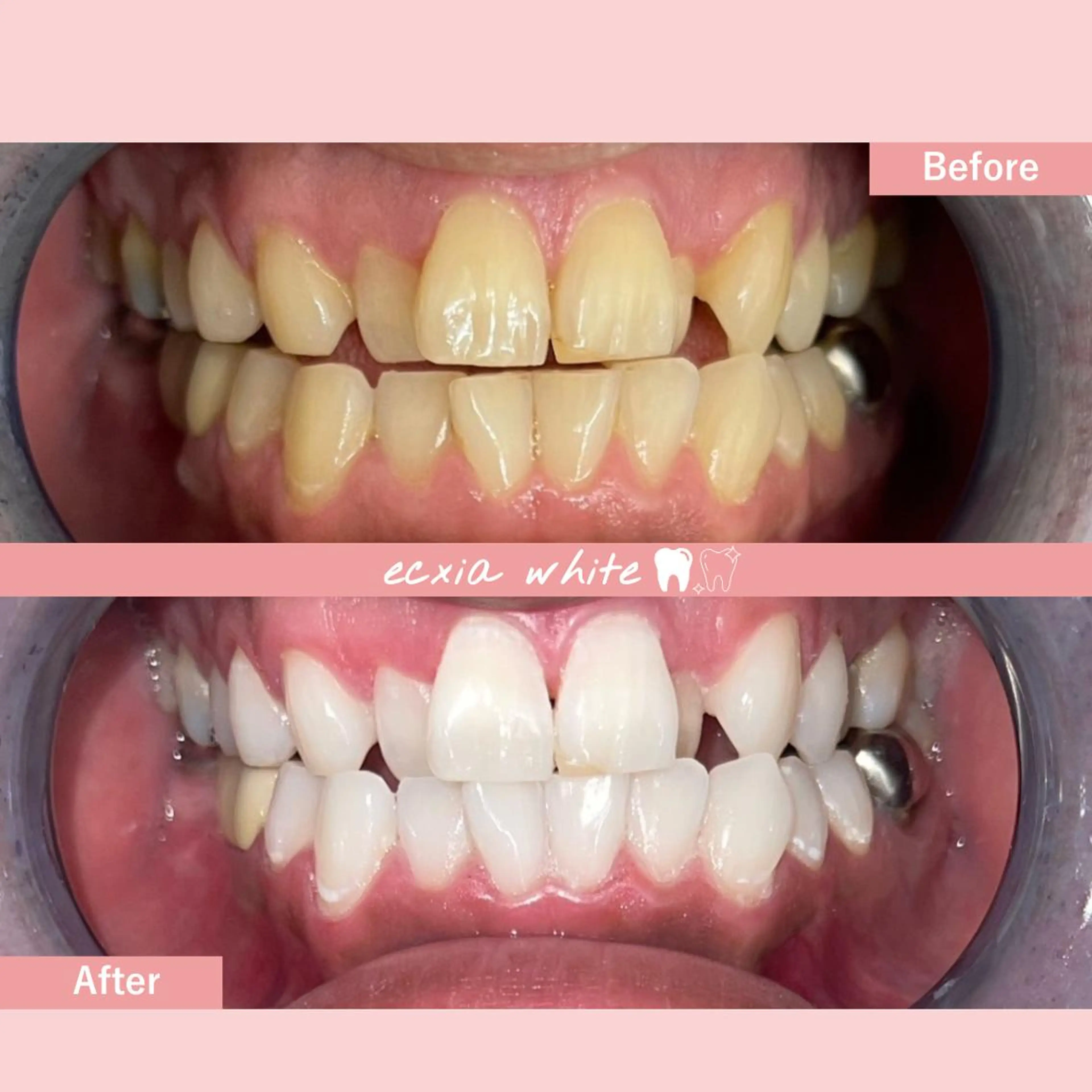 セルフホワイトニング エクシア中島公園店のその他イメージ