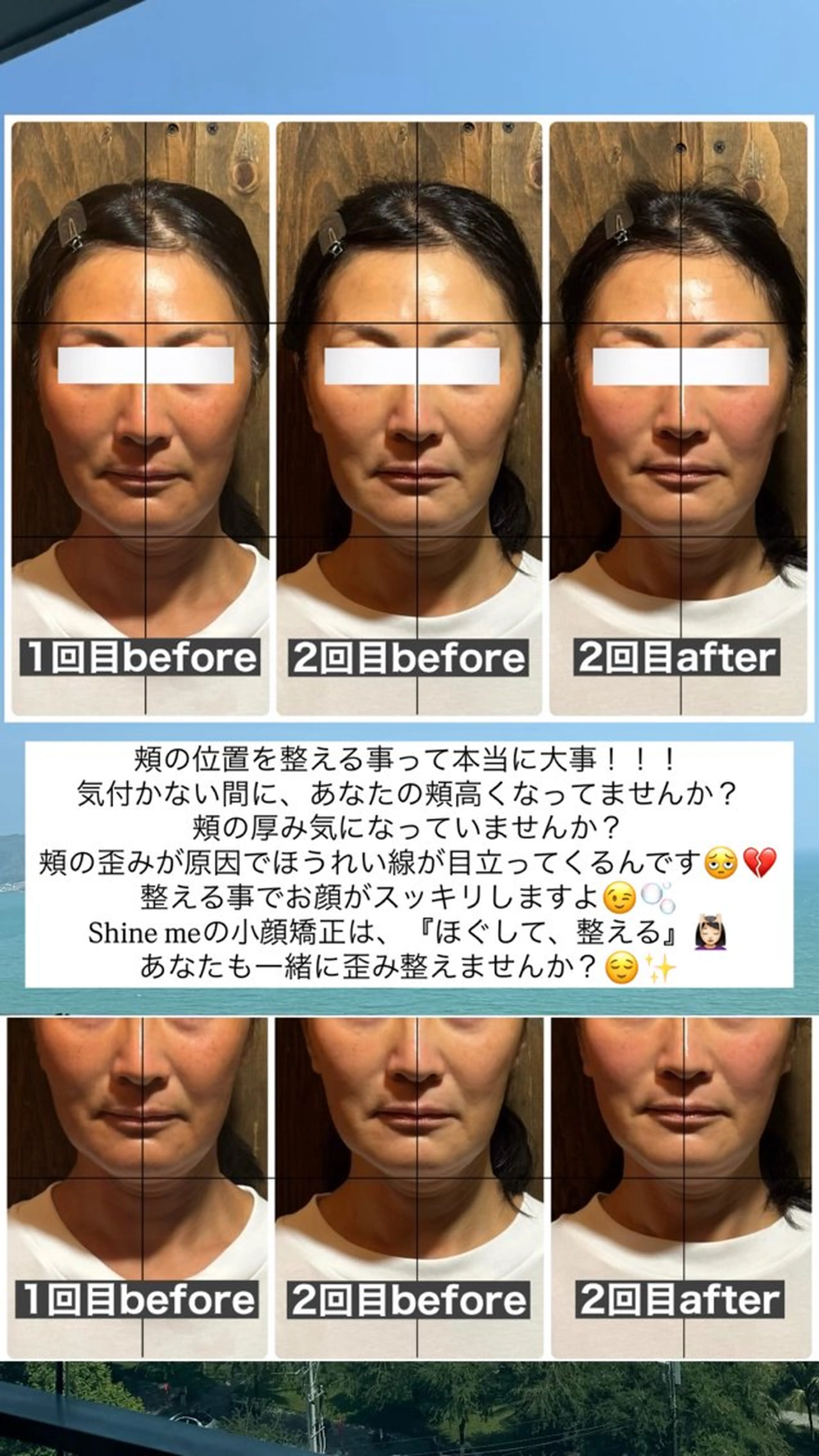 エステ リラク 💎後悔させない小顔 矯正💎イトヤマ🌱のエステ・リラクイメージ