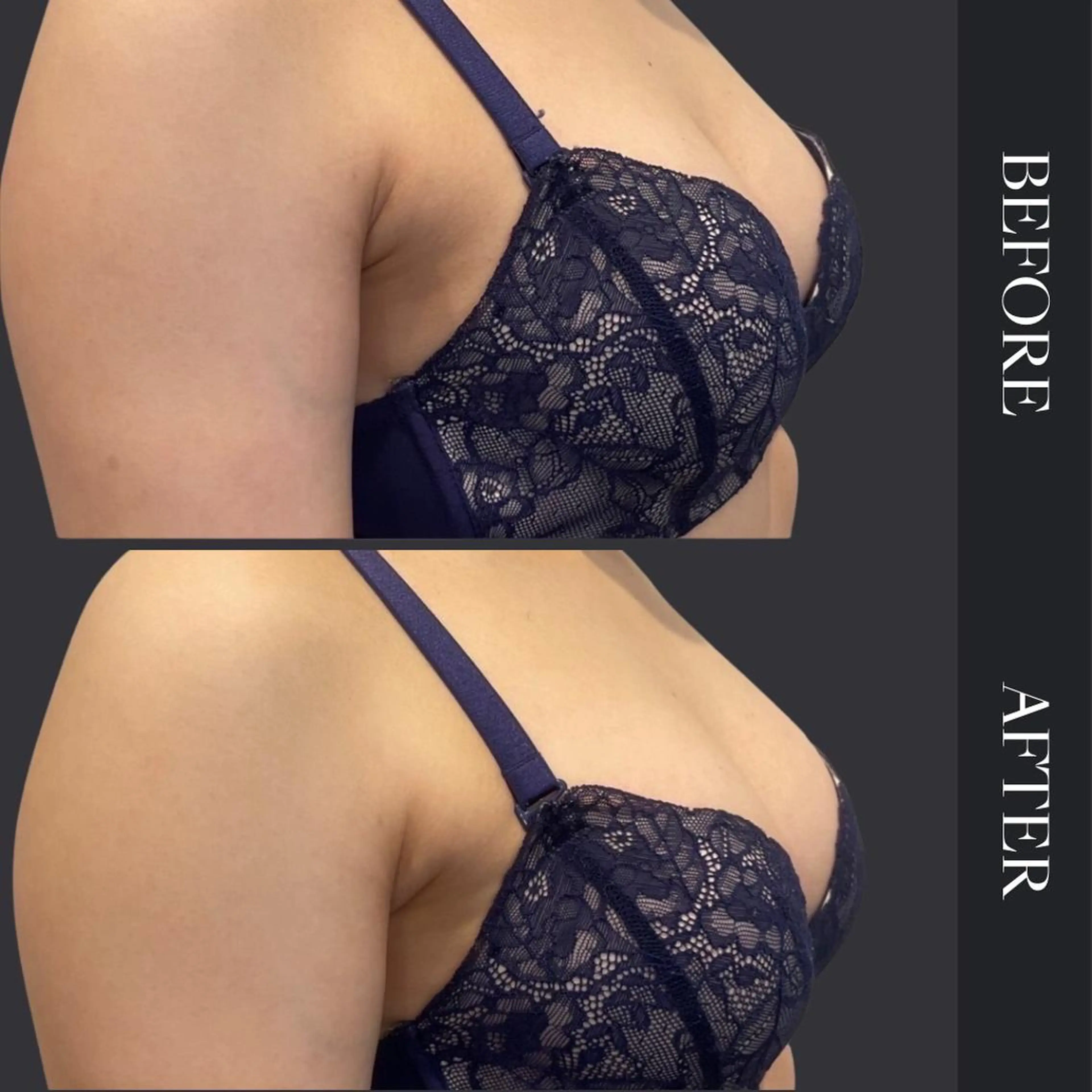 口コミ&モニター限定価格💕【30代】癒され🌺モテバストアップ痩身❤️の写真