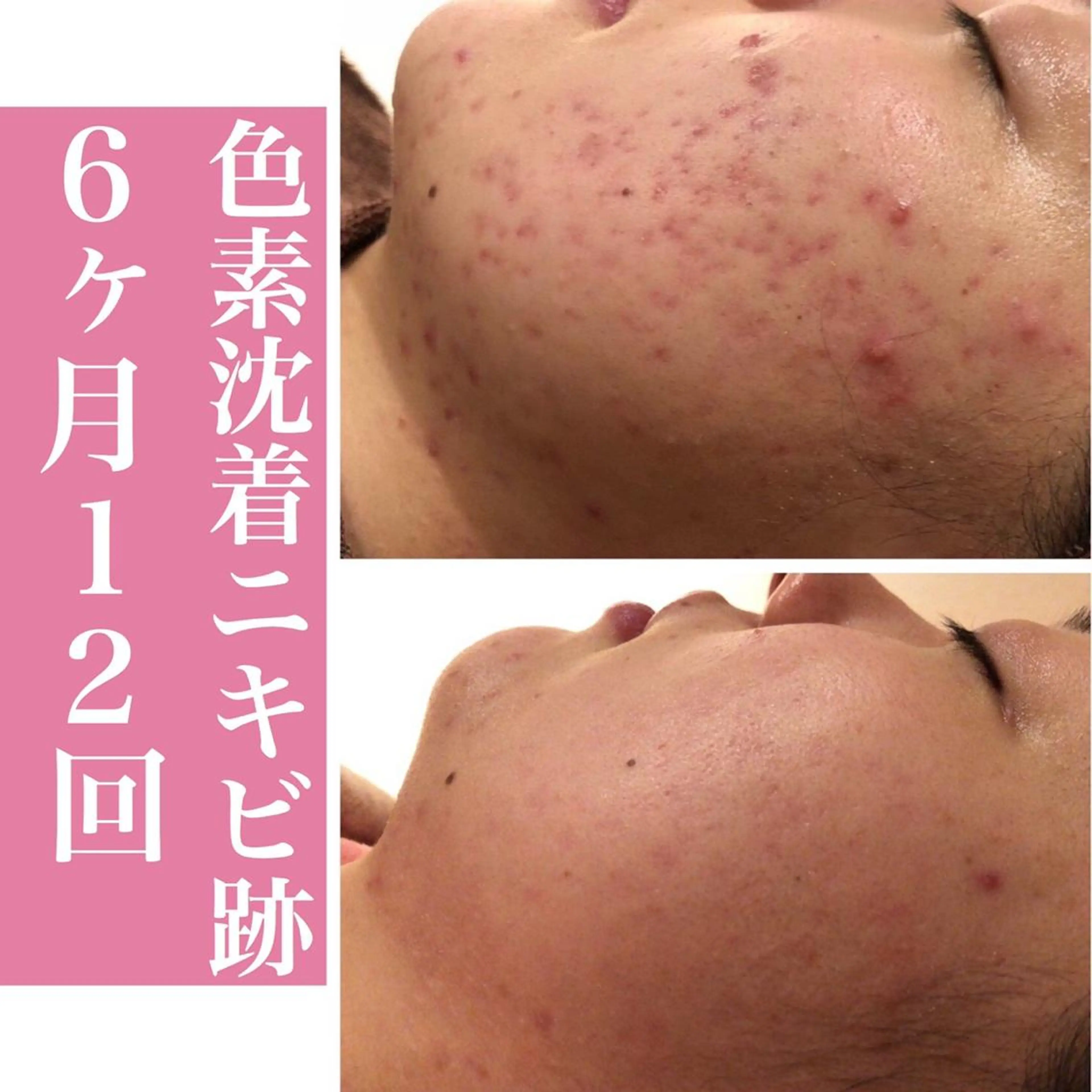 ミディアム カラー パーマ ヘアアレンジ メンズ キッズ ネイル マツエク・マツパ アイブロウ ニキビ・肌質改善専門 ♡人生が変わるサロンのエステ・リラクイメージ