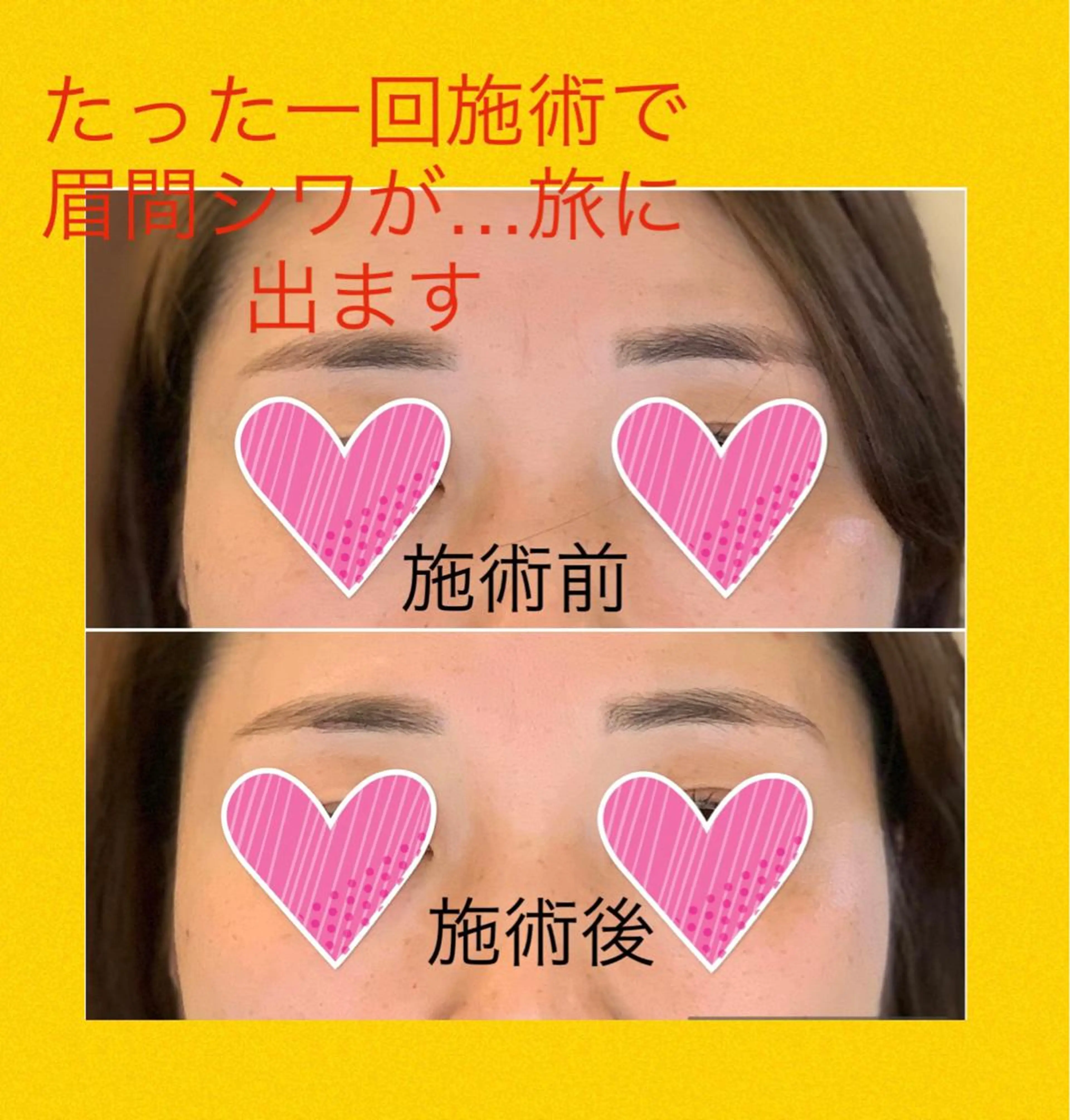 整体フェイシャル EMINALのエステ・リラクイメージ