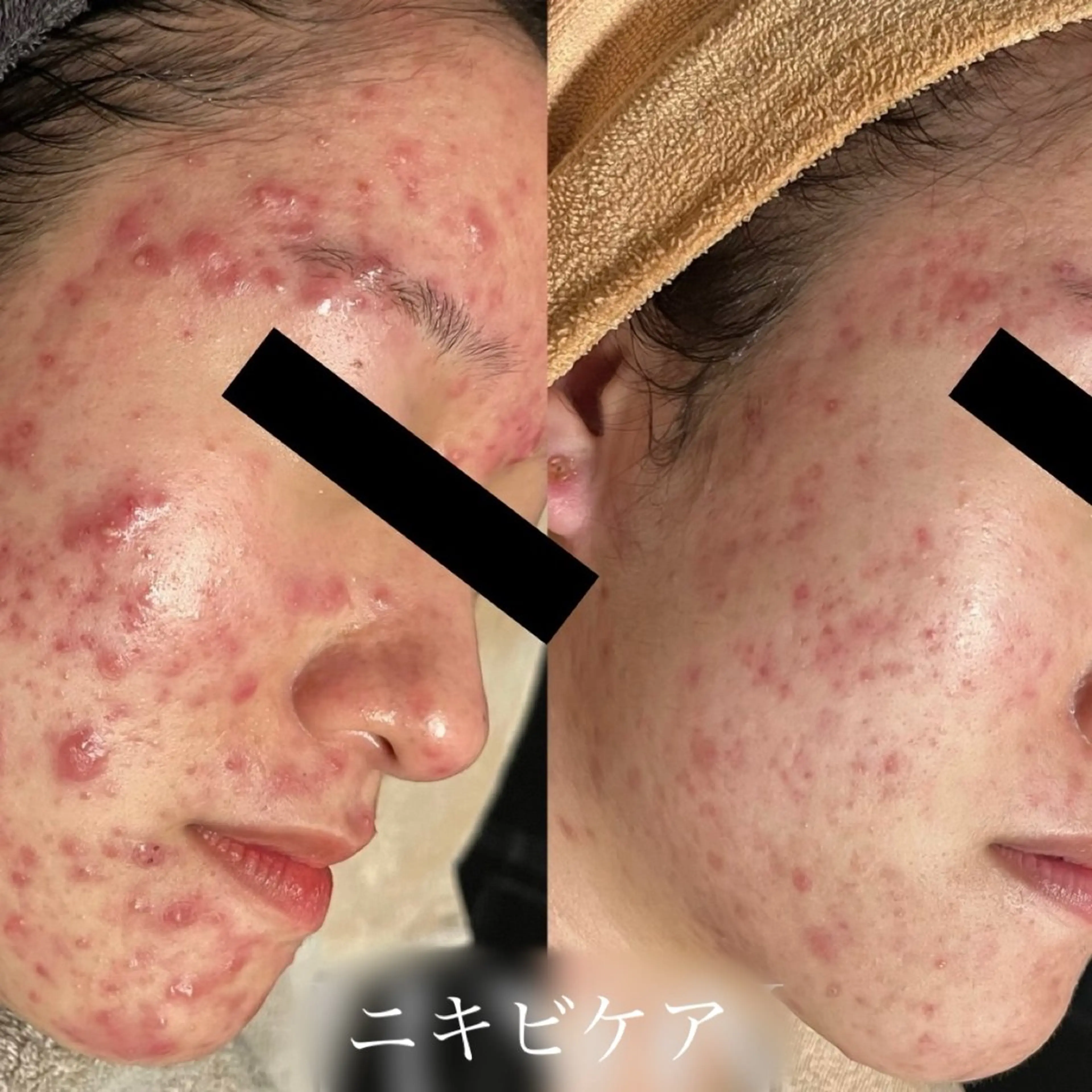 rejena 山口のエステ・リラクイメージ