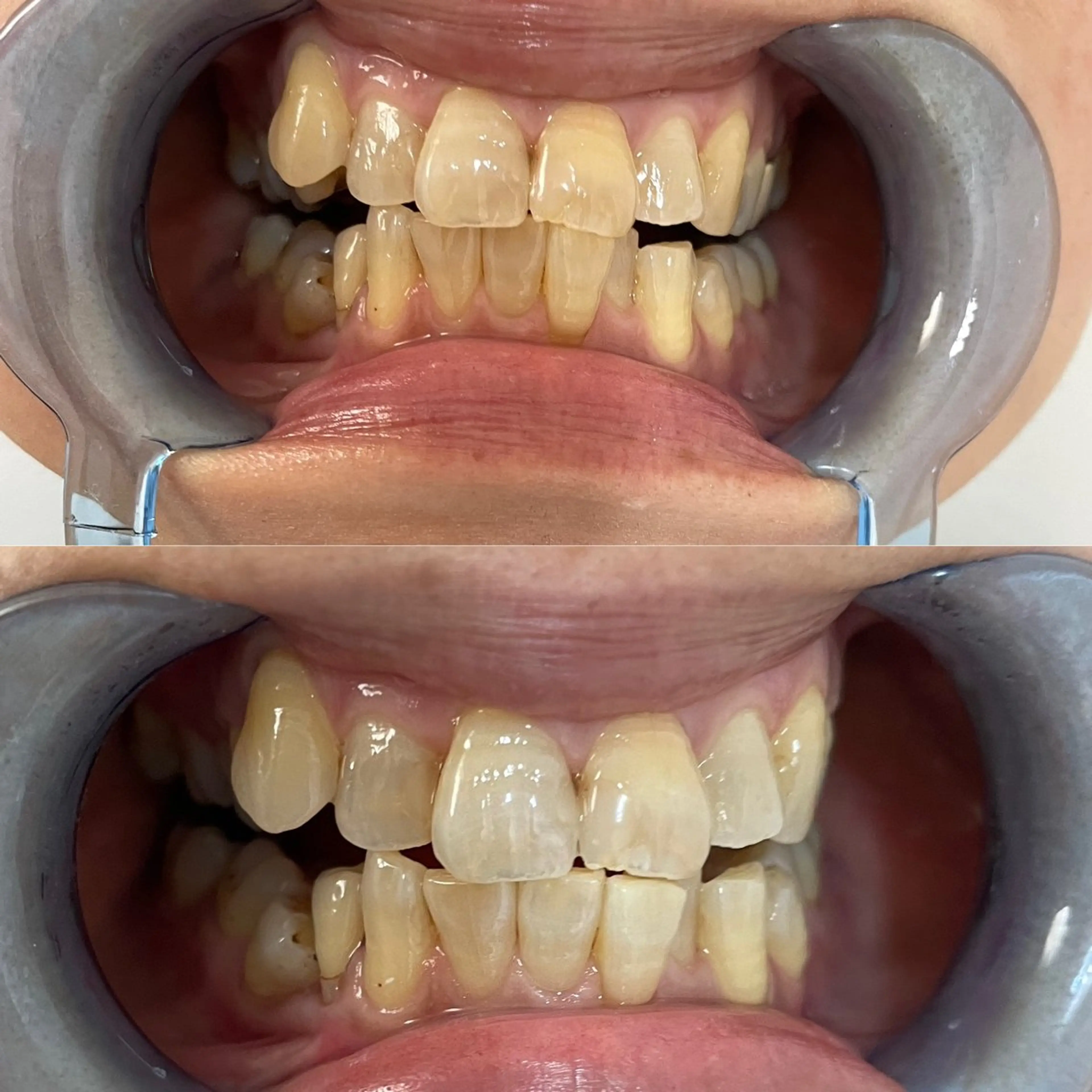 西宮ホワイトニング Kirarie所属・志水 有美のエステ・リラクイメージ