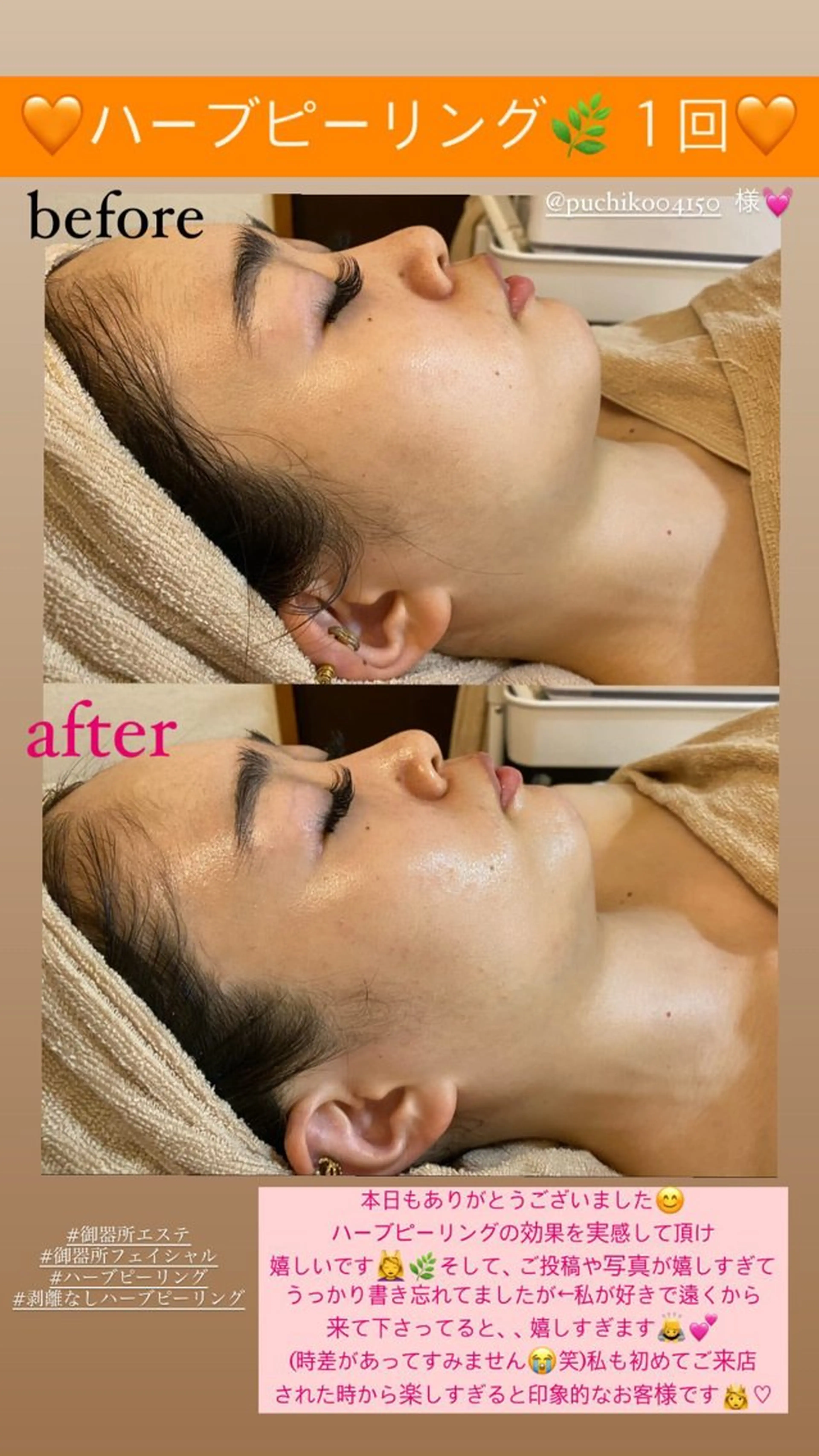 メンズ エステ Salon de Lino 御器所のエステ・リラクイメージ