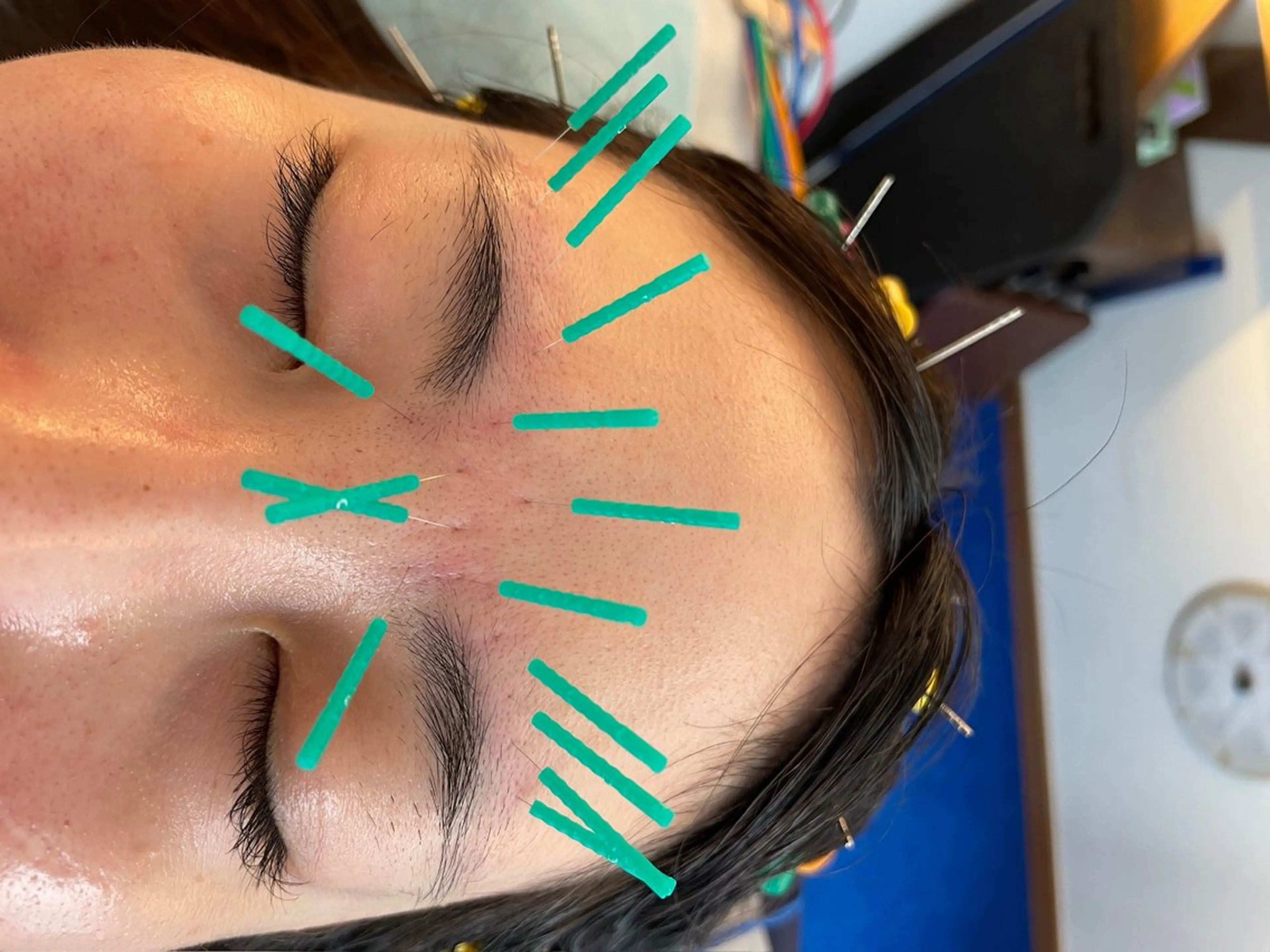 小顔美容鍼専門サロン 渋谷YZのその他イメージ