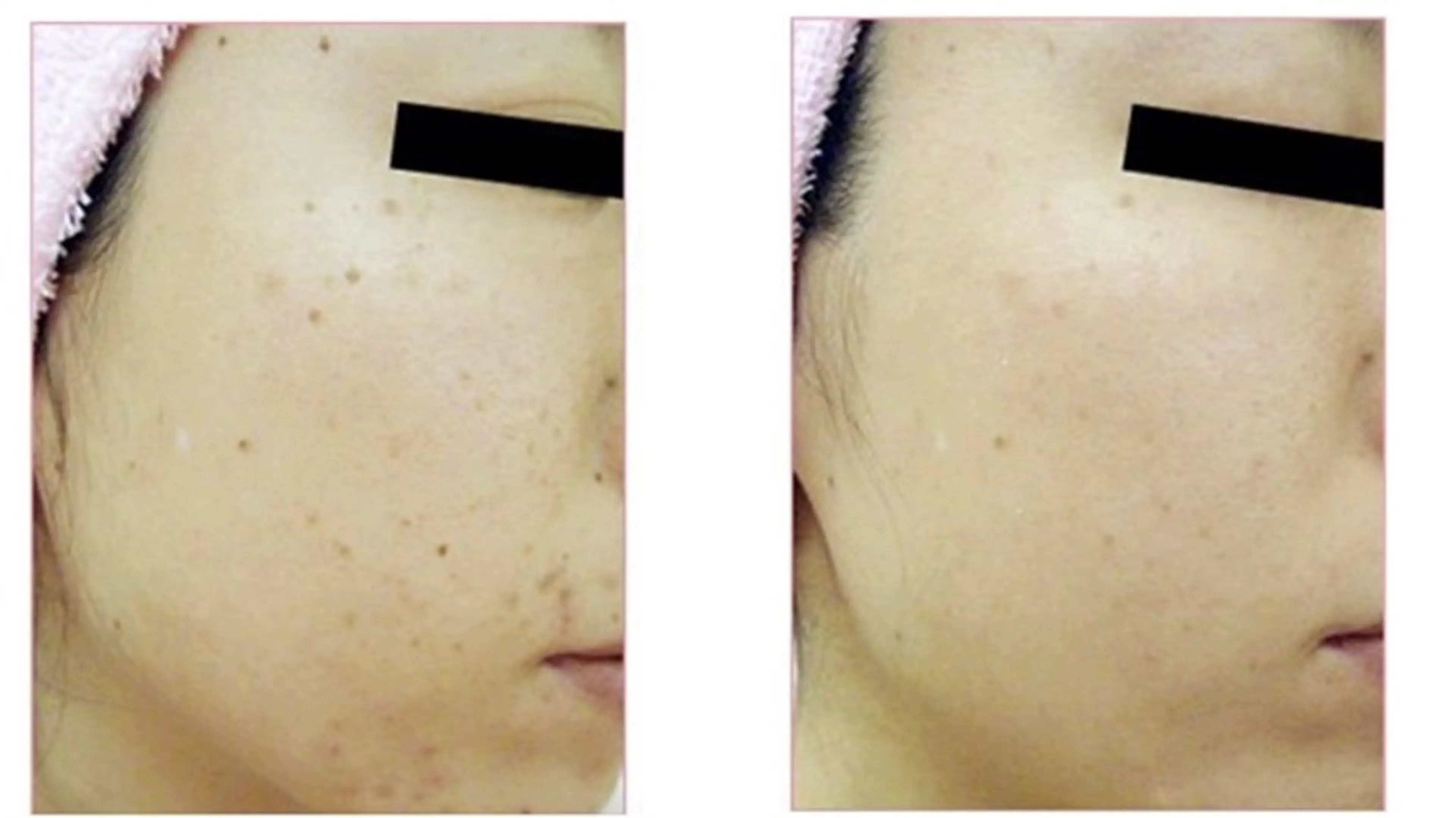 エステ LiZA エステティックサロンのその他イメージ