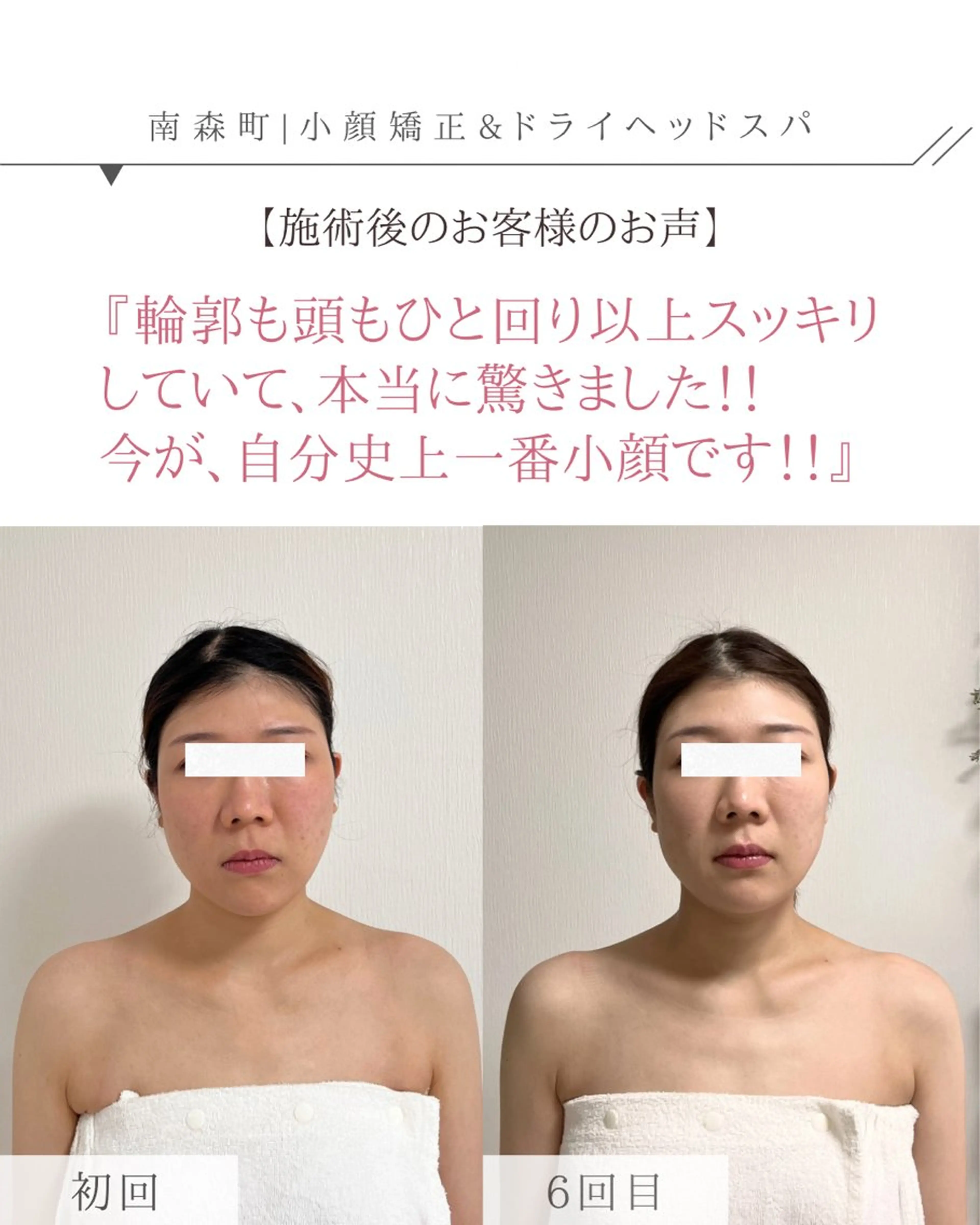 ドライヘッドスパ専門店 SIESTA所属・ドライヘッドスパ 専門店SIESTAのエステ・リラクイメージ