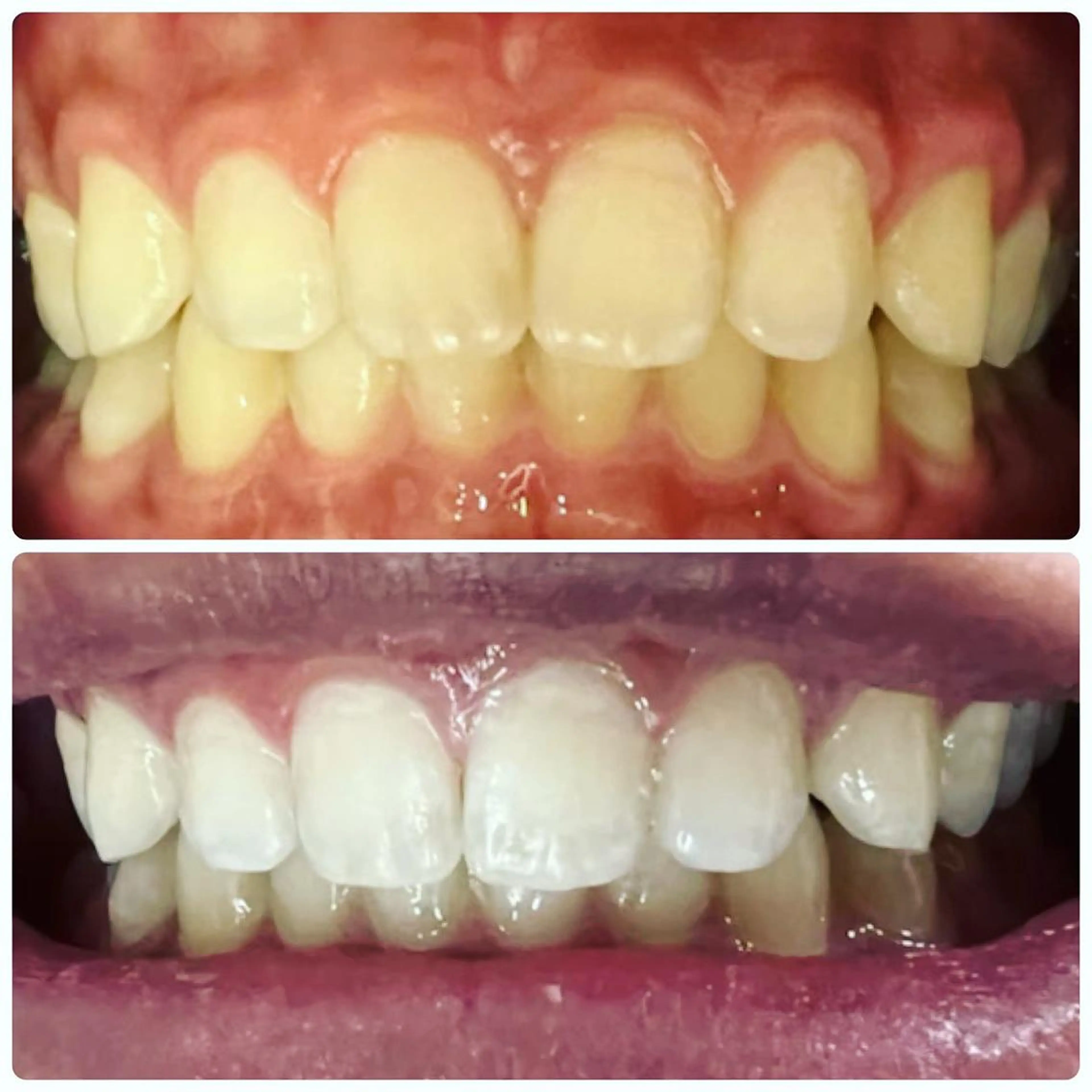 その他 LOVE ホワイトニング戸辺のその他イメージ