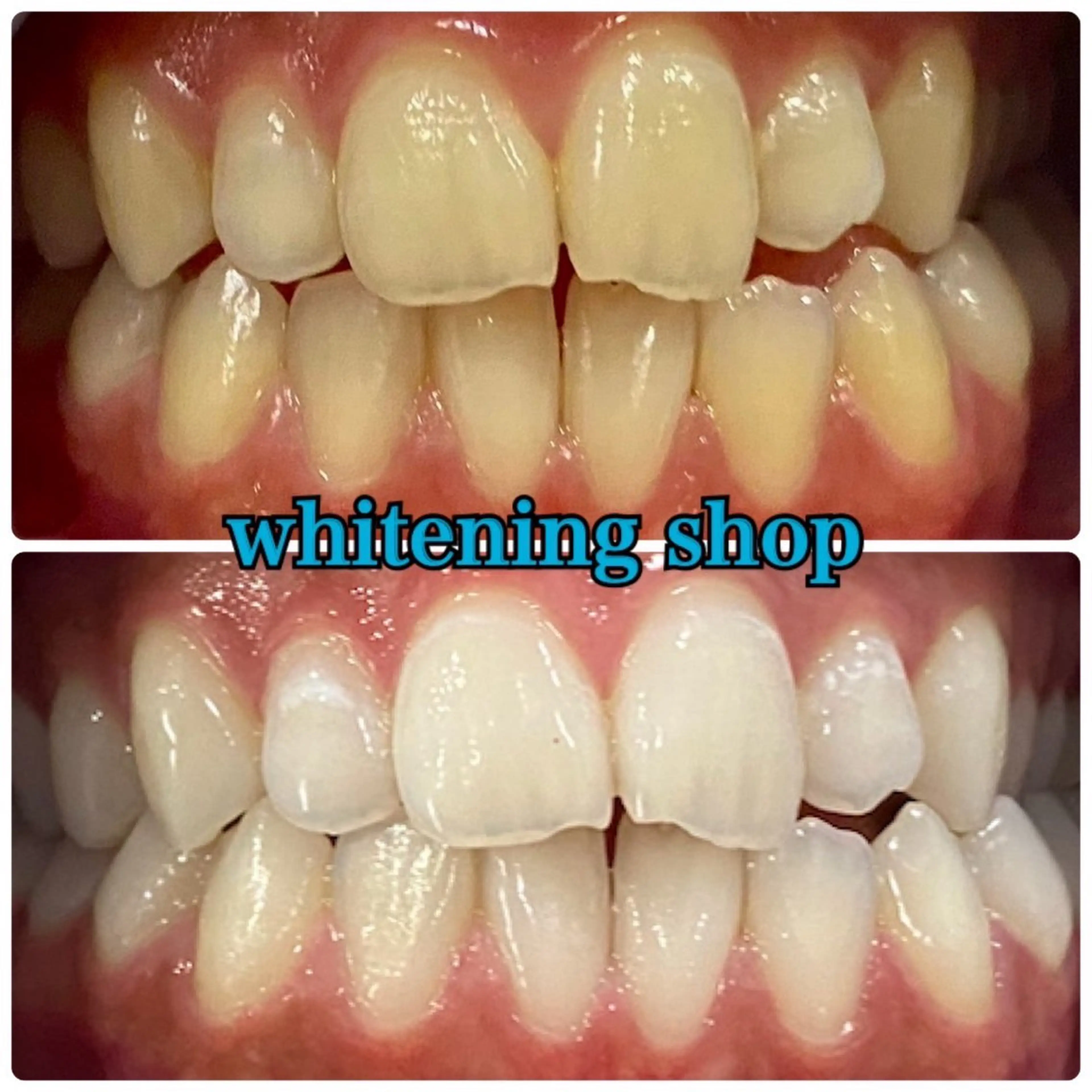 ホワイトニングショップ津店所属・ホワイトニング ショップ津店のその他イメージ