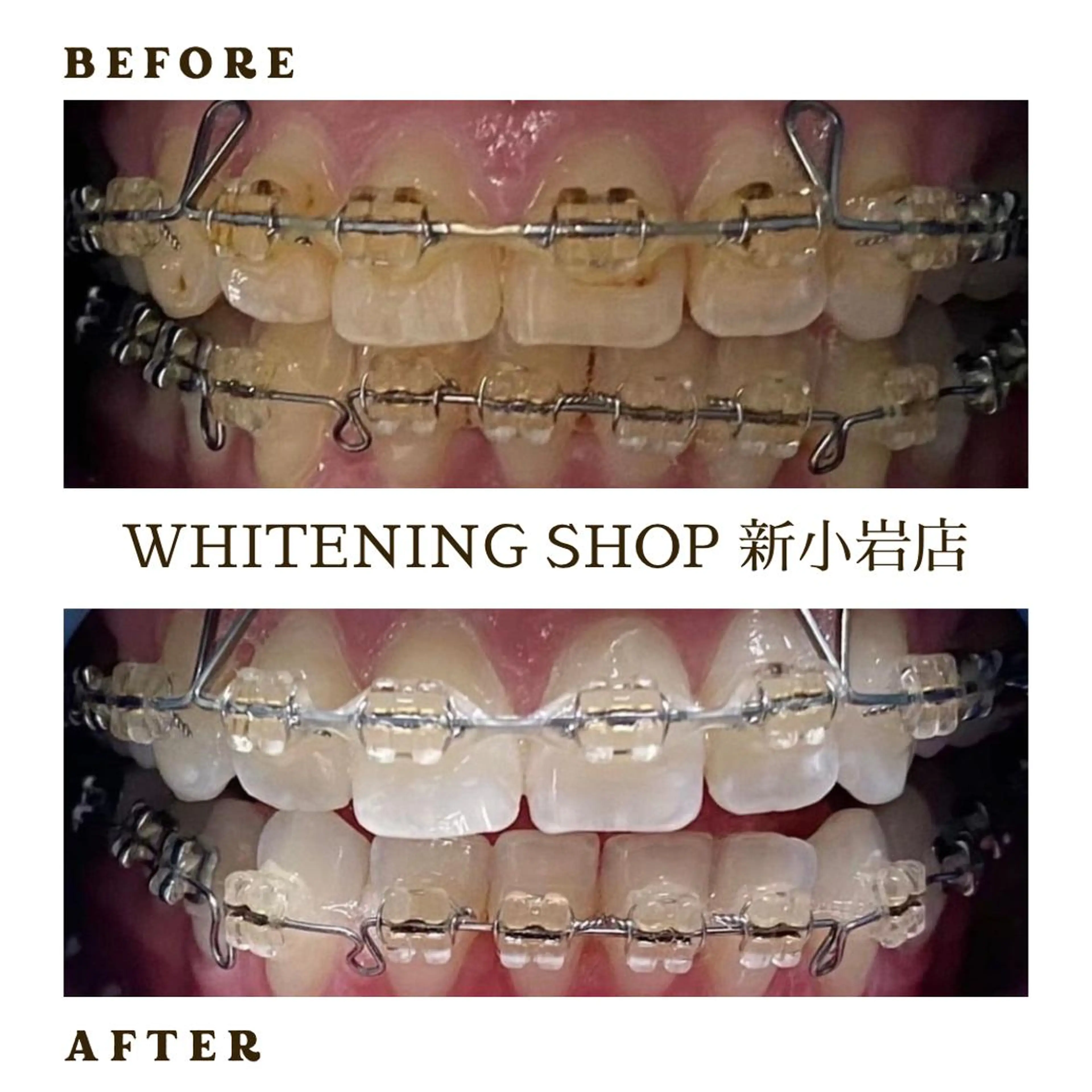 その他 ホワイトニング ショップ新小岩店のその他イメージ