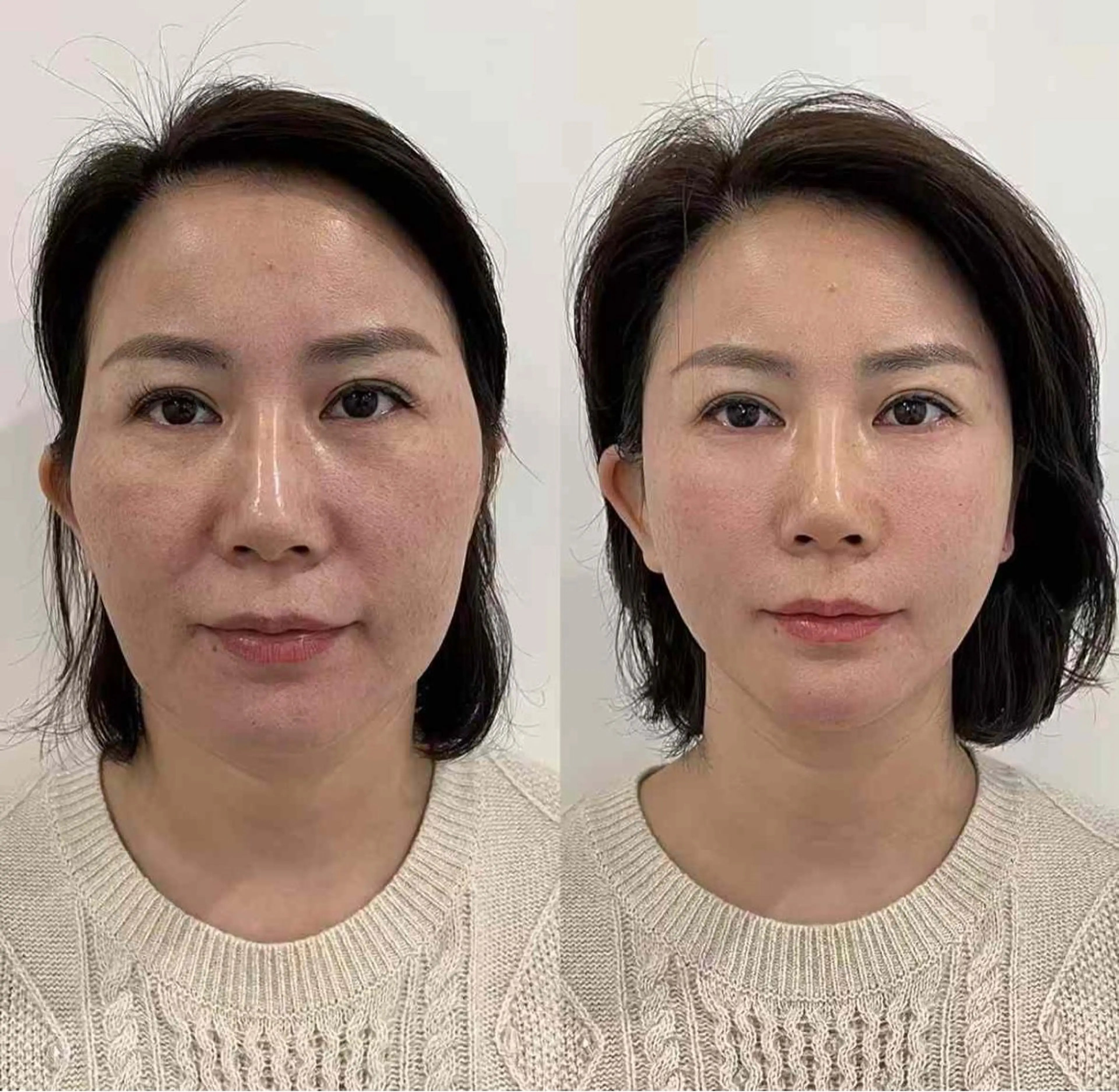 ネイル エステ aliaハイフ&水光ジェットサロン所属・aliaハーブ水光店 エステティシャン募集のエステ・リラクイメージ