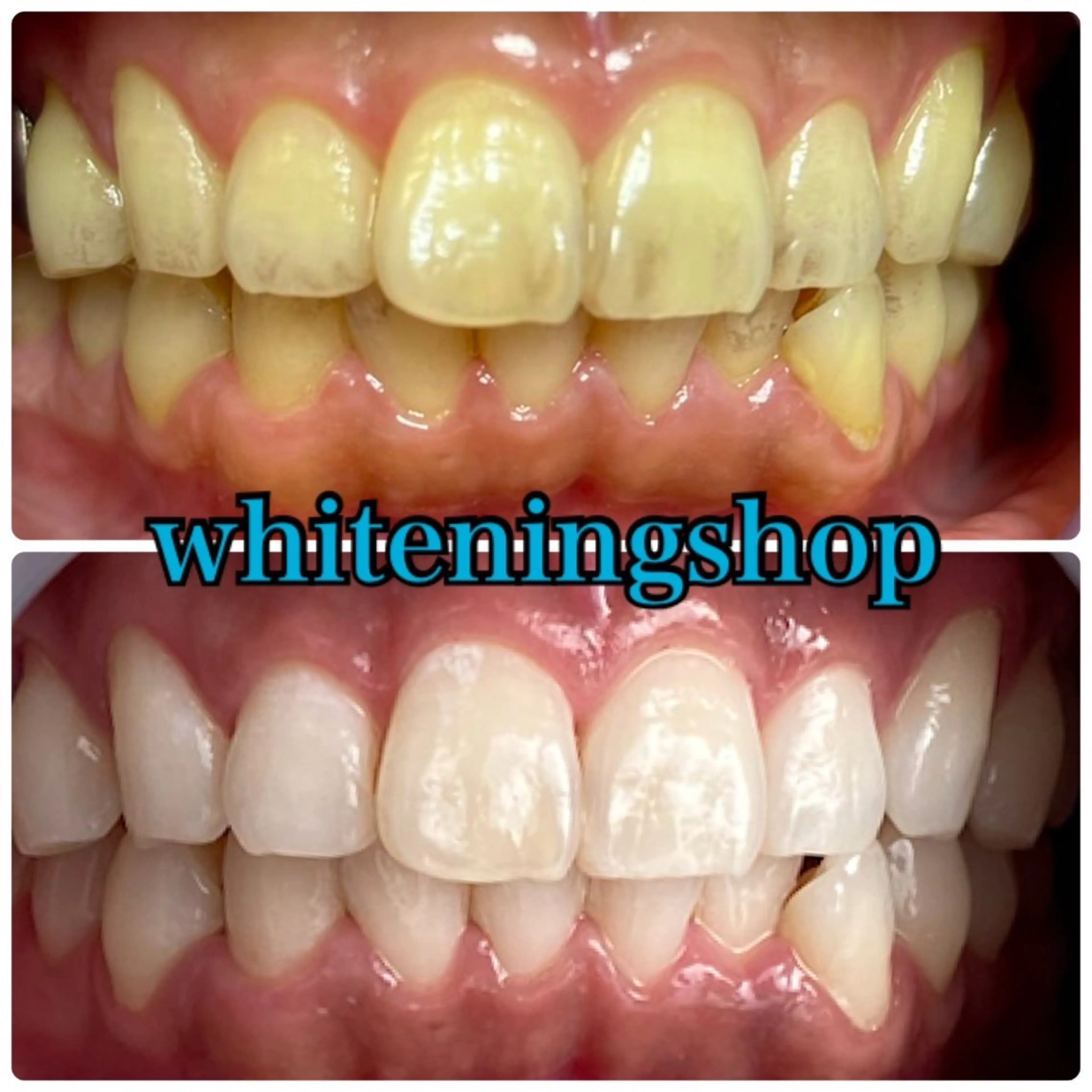 エステ リラク ホワイトニング ショップ吉祥寺店のエステ・リラクイメージ