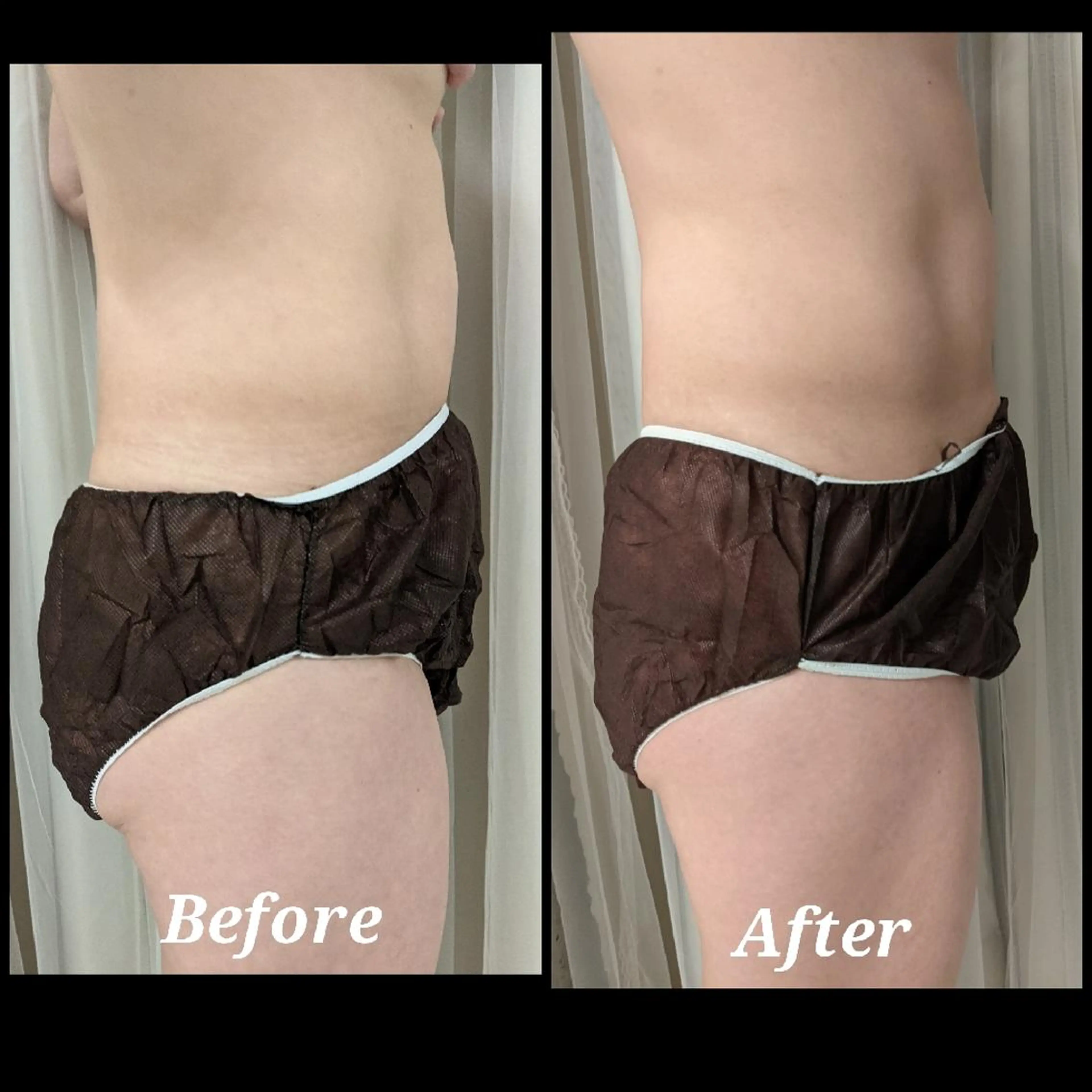 整体エステ　NEW ME所属・深層リンパオイル/小 顔とドライヘッドスパのエステ・リラクイメージ