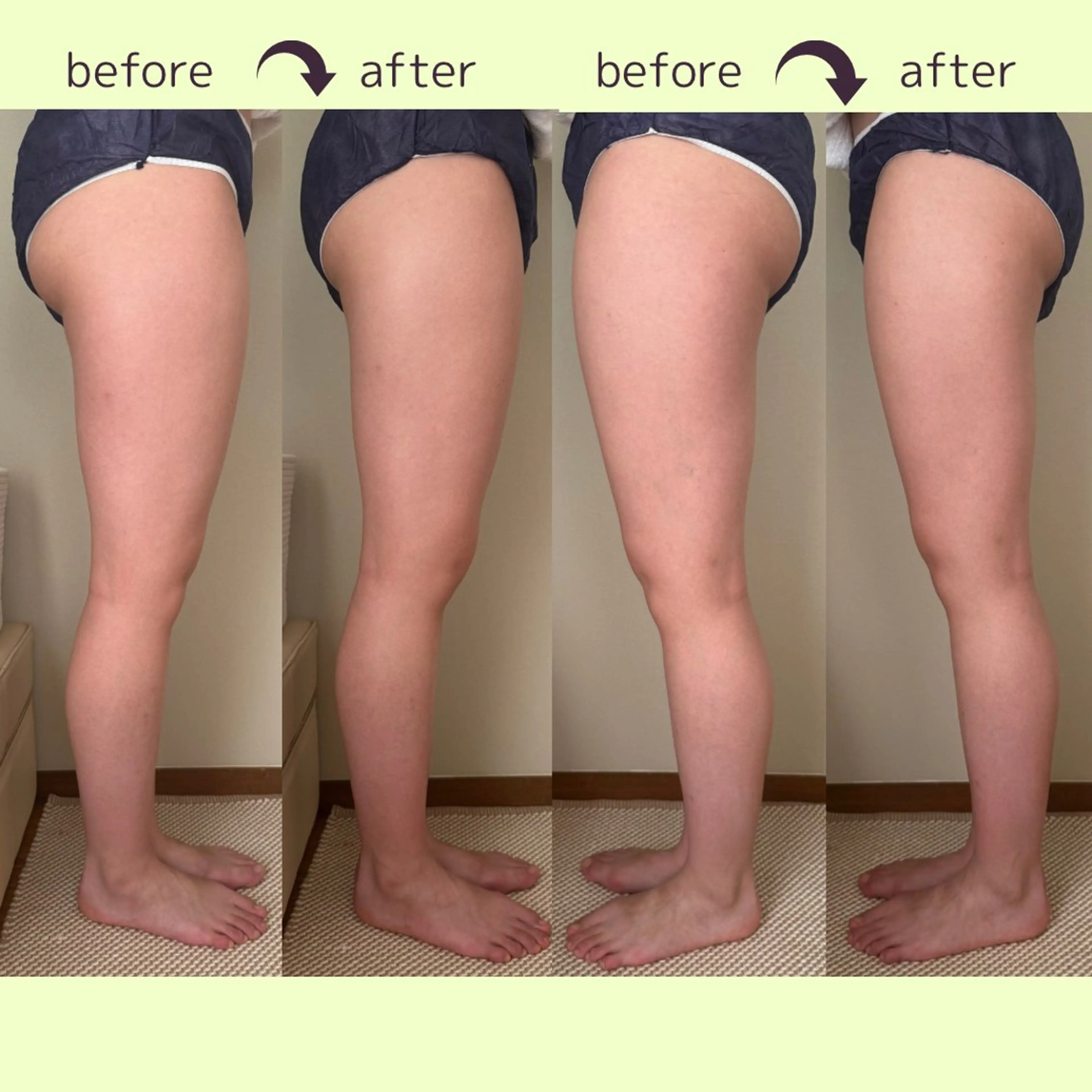 足の疲れ美脚コース✨セルライト🌀むくみを潰して押し流す‼️【下半身集中50分➕足湯ほぐし10分】の写真