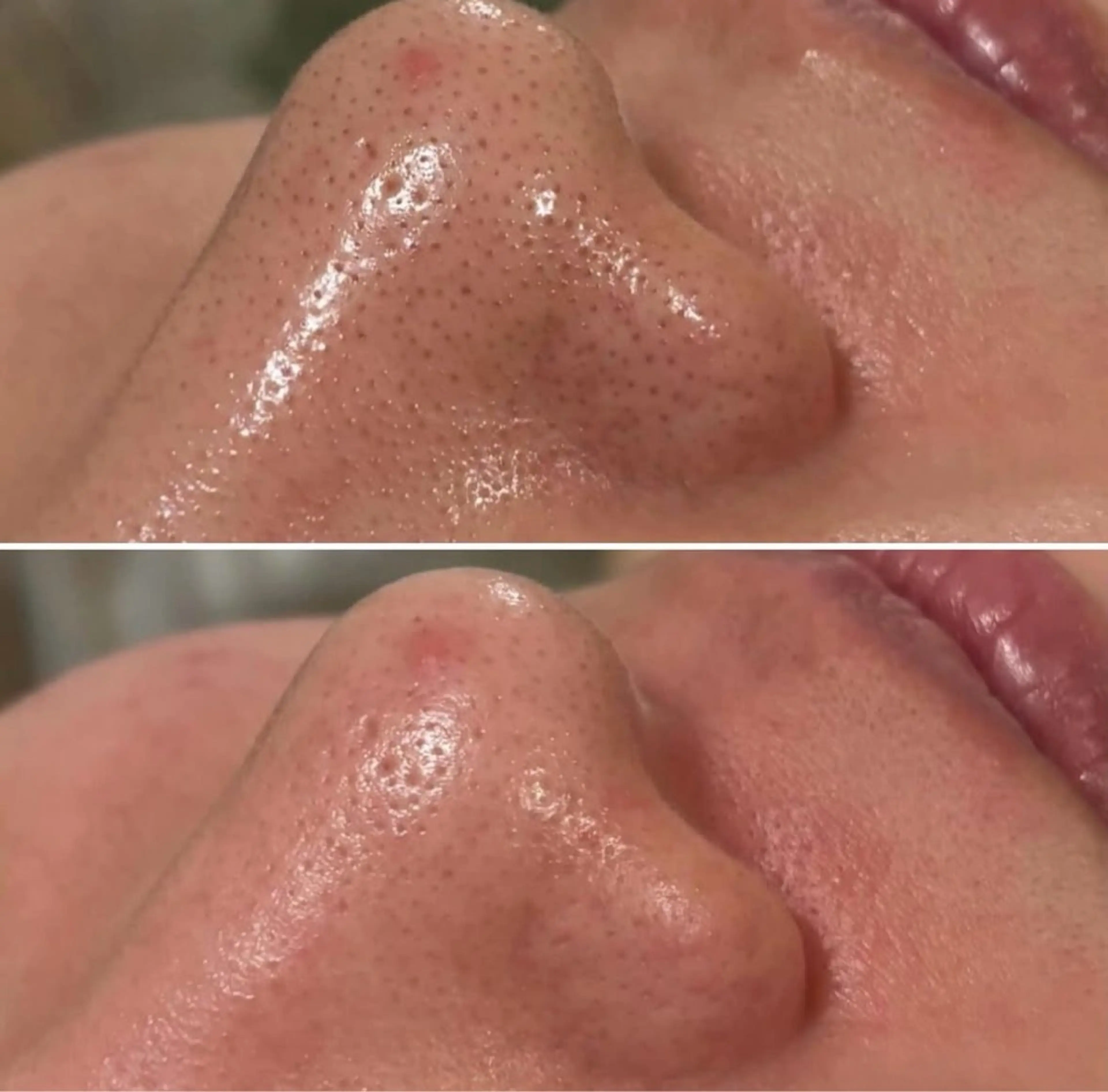 エステ A"-HILU(アーヒル)所属・A"-HILU （アーヒル)のエステ・リラクイメージ