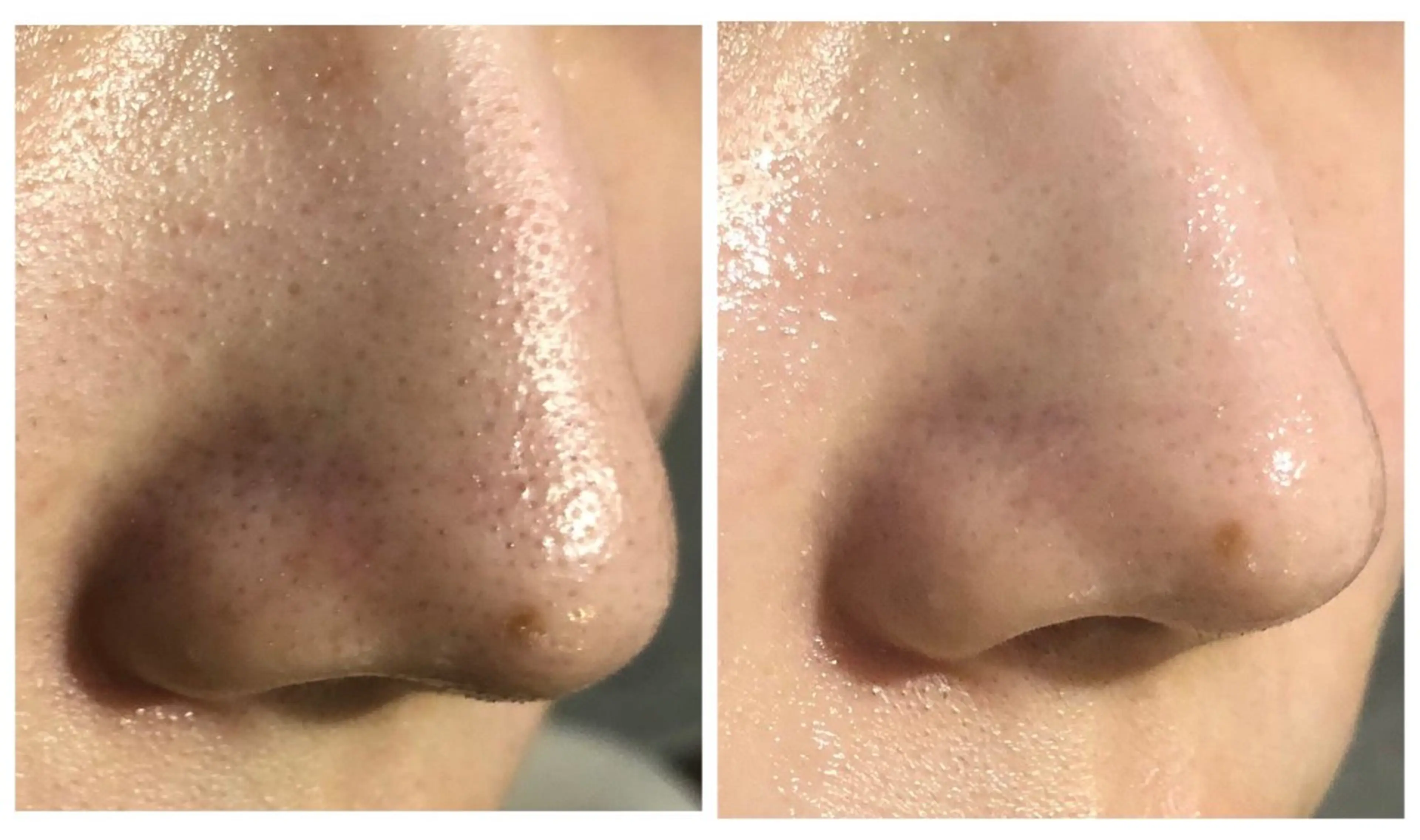 🐆アンドウ チカコ🦓のヘアスタイル