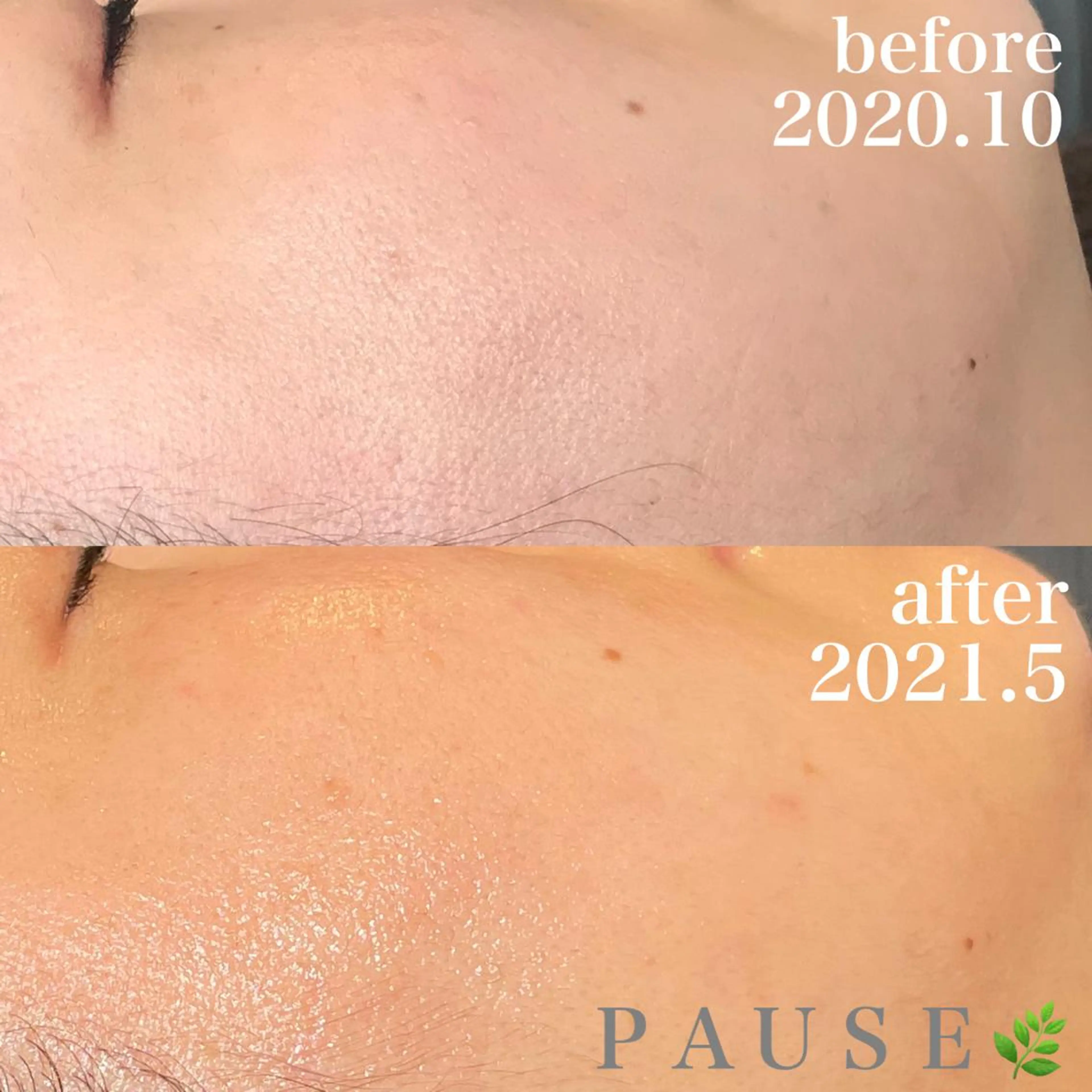 エステ 浜野 恵美のエステ・リラクイメージ