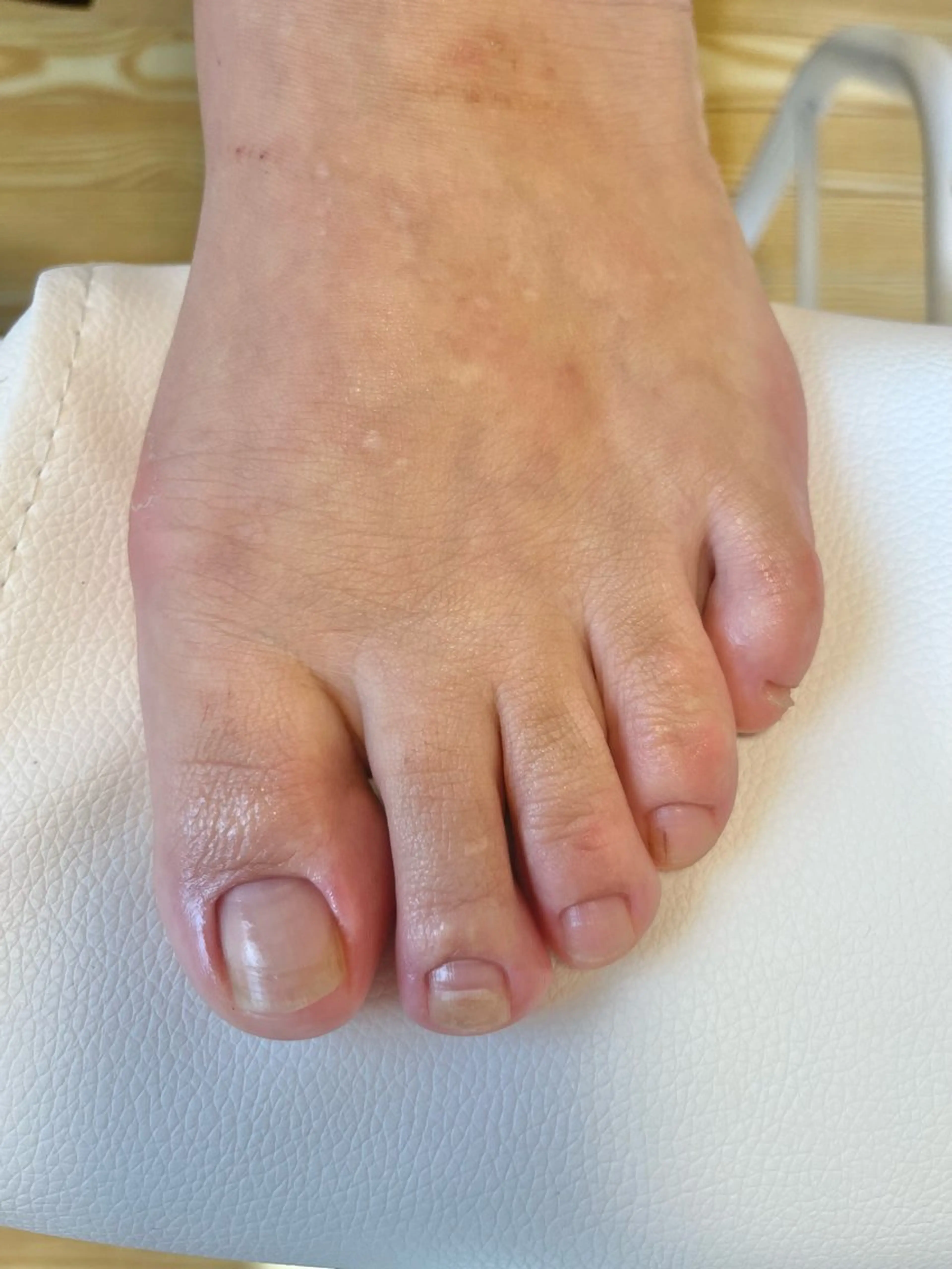 【ミニモ限定】フット自爪ケアの写真