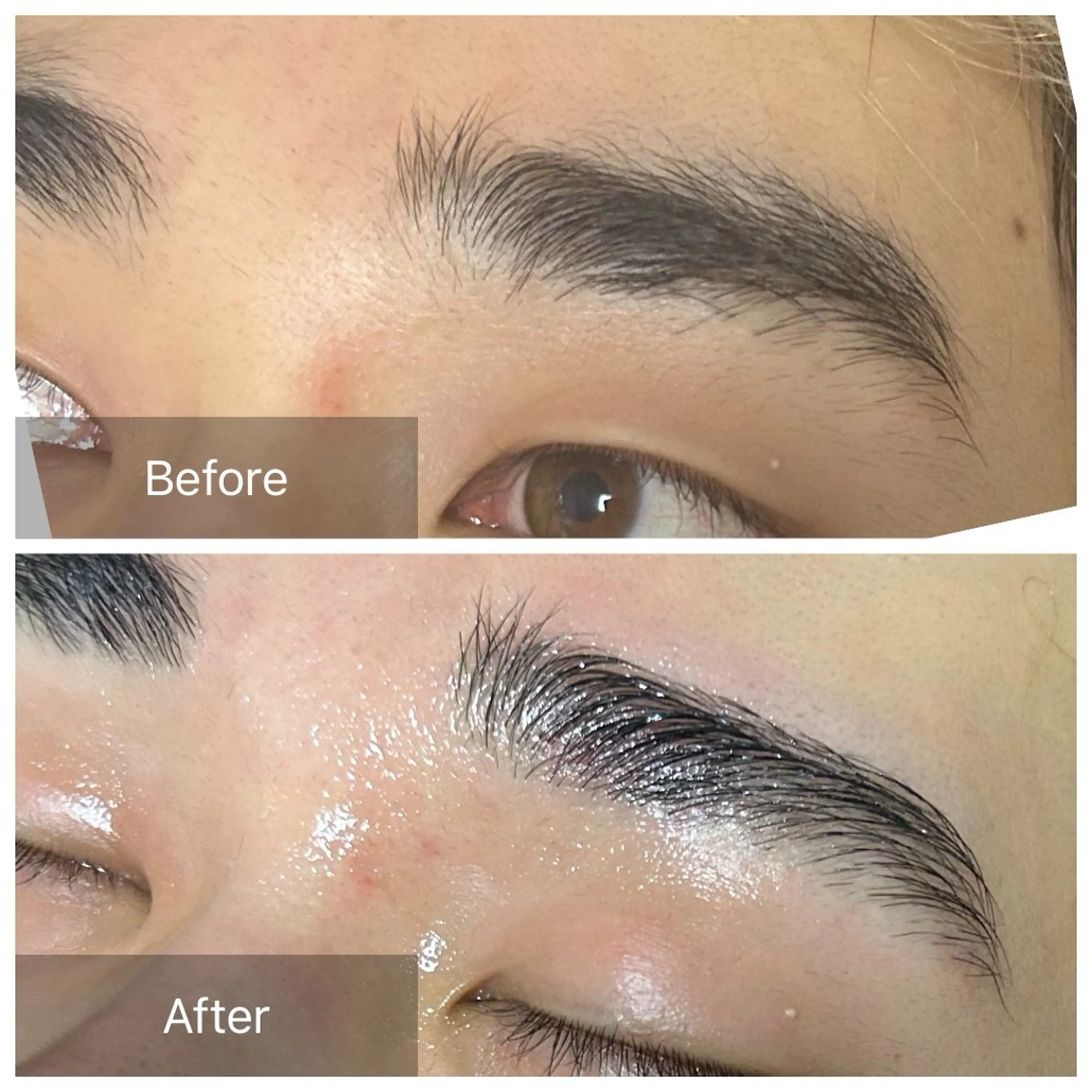 【人気のメニューのセット！】ヒゲ脱毛＋眉ワックスの写真