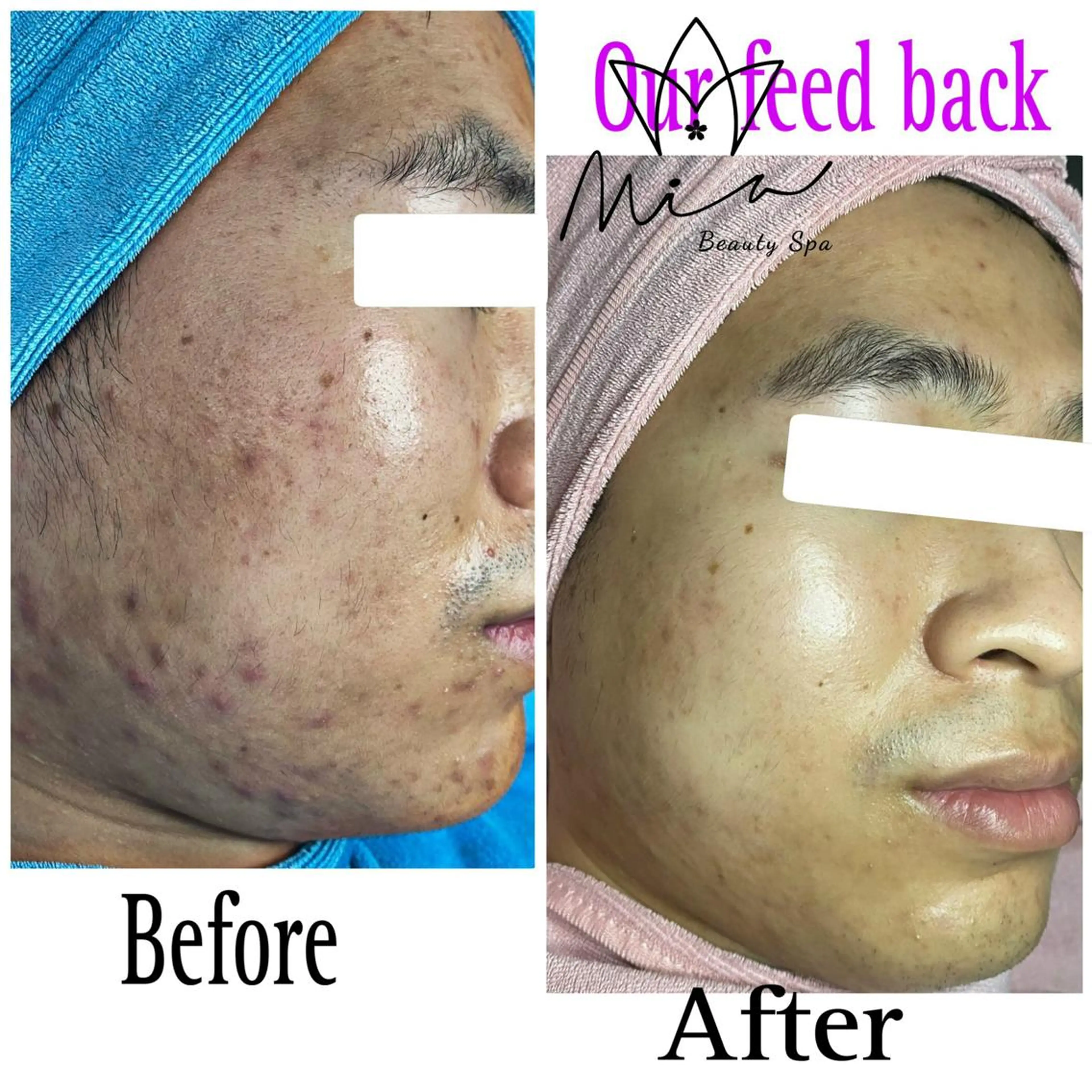 Mia beauty所属・MiA Beautyのエステ・リラクイメージ