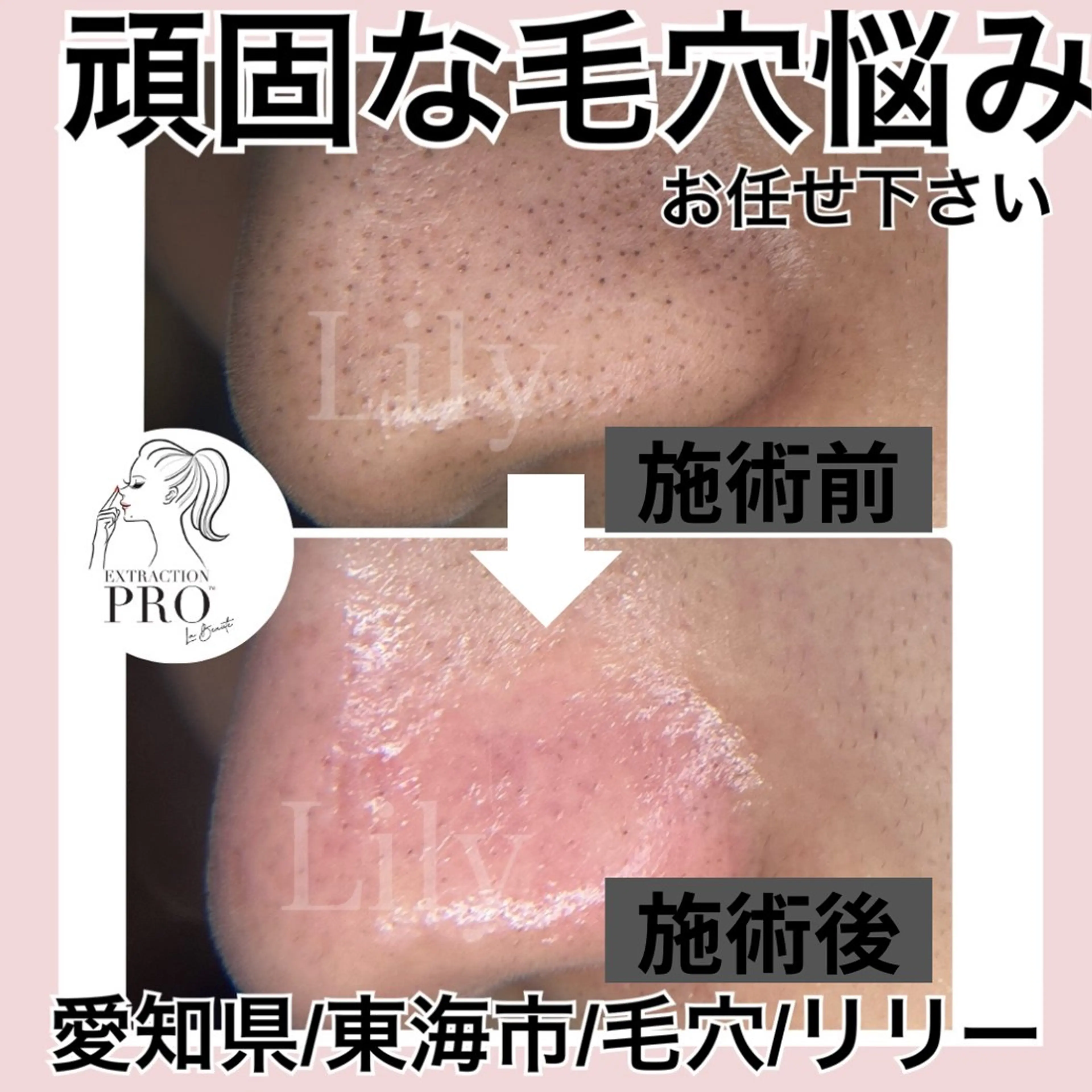 トータルビューティー サロンLilyのエステ・リラクイメージ