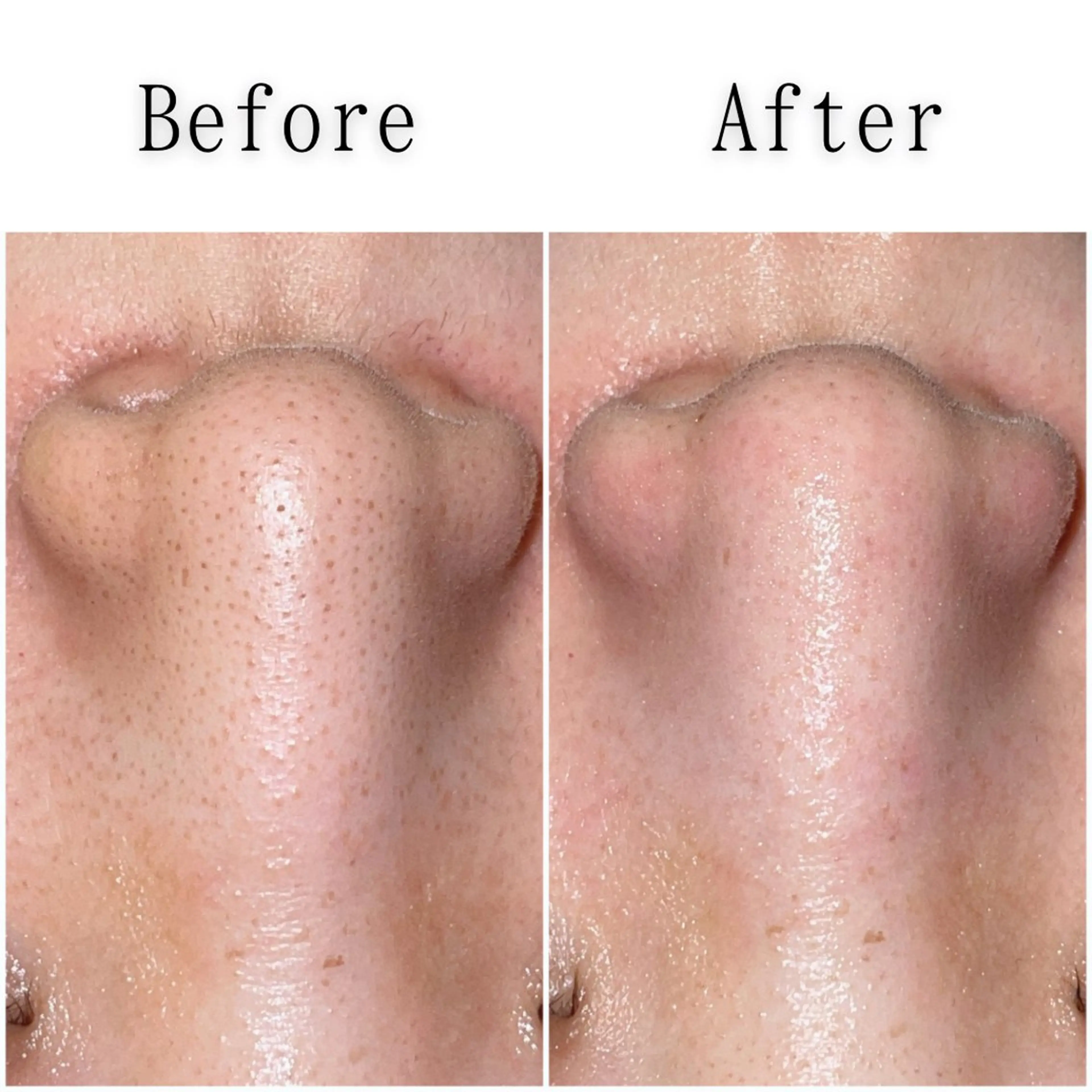 エステ SELF  BEAUTY gracia浦添店所属・gracia 浦添店のその他イメージ