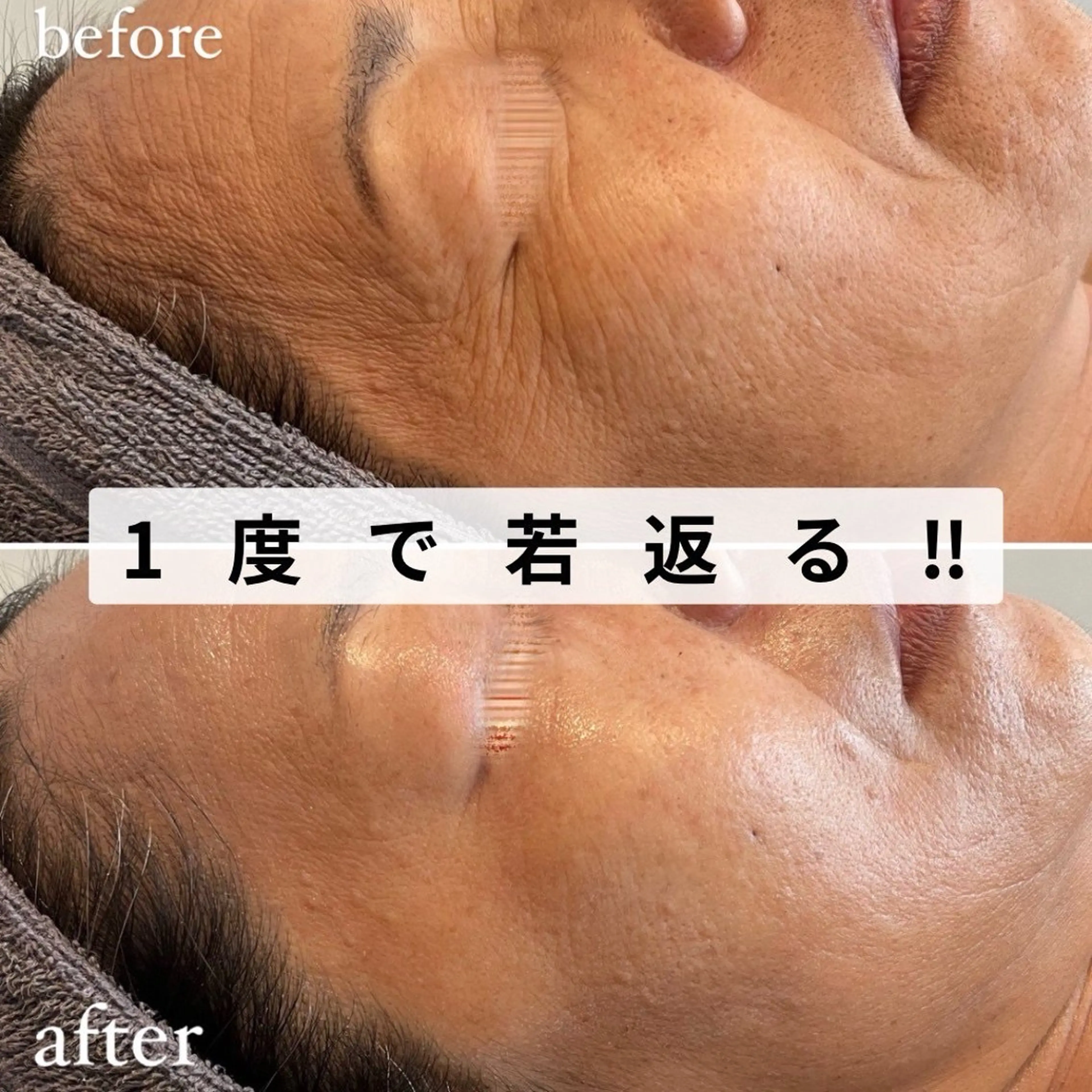 エステ private salon  Koiのその他イメージ