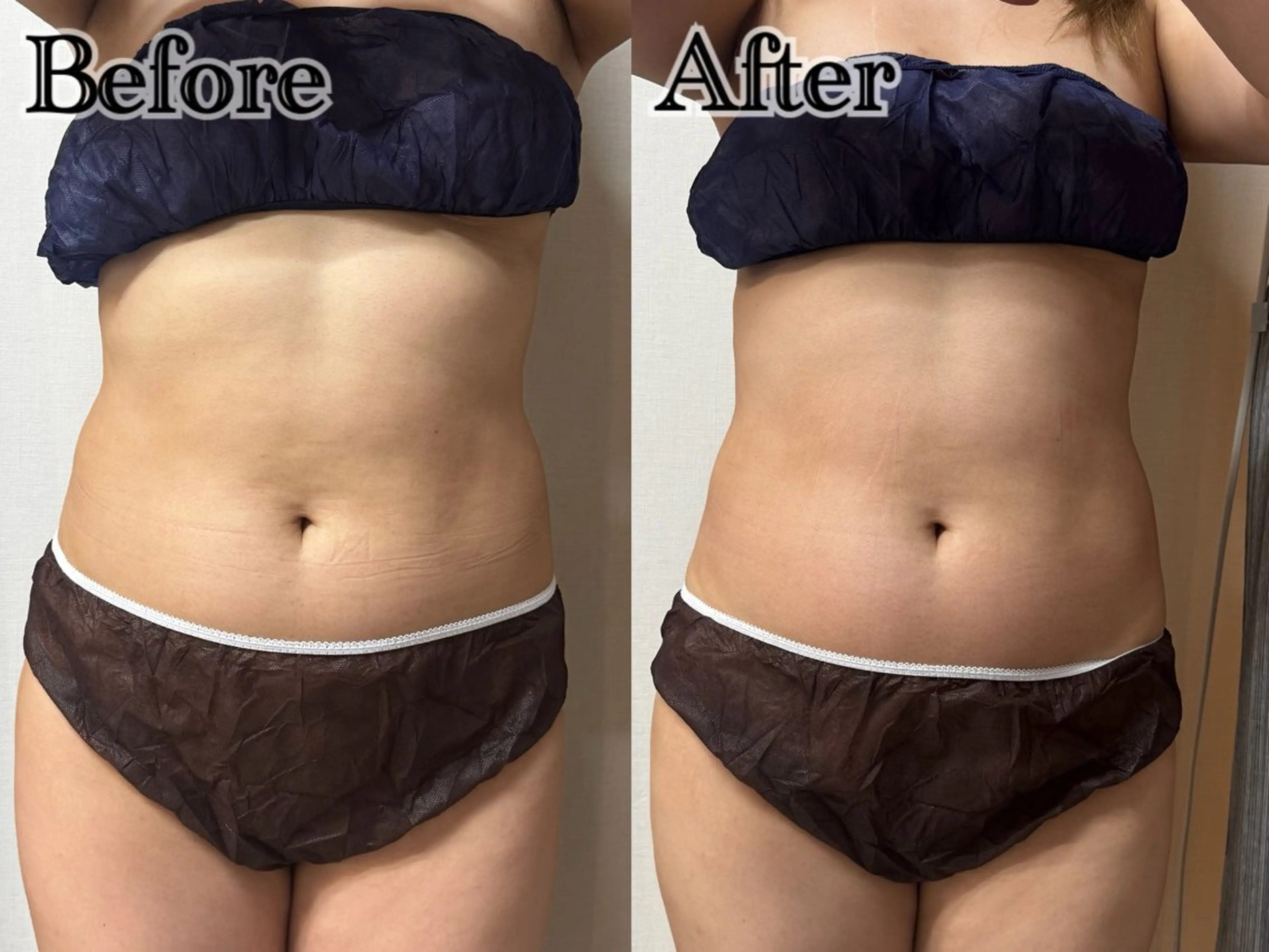 エステ 六本木脱毛andS 店長Sachiのエステ・リラクイメージ