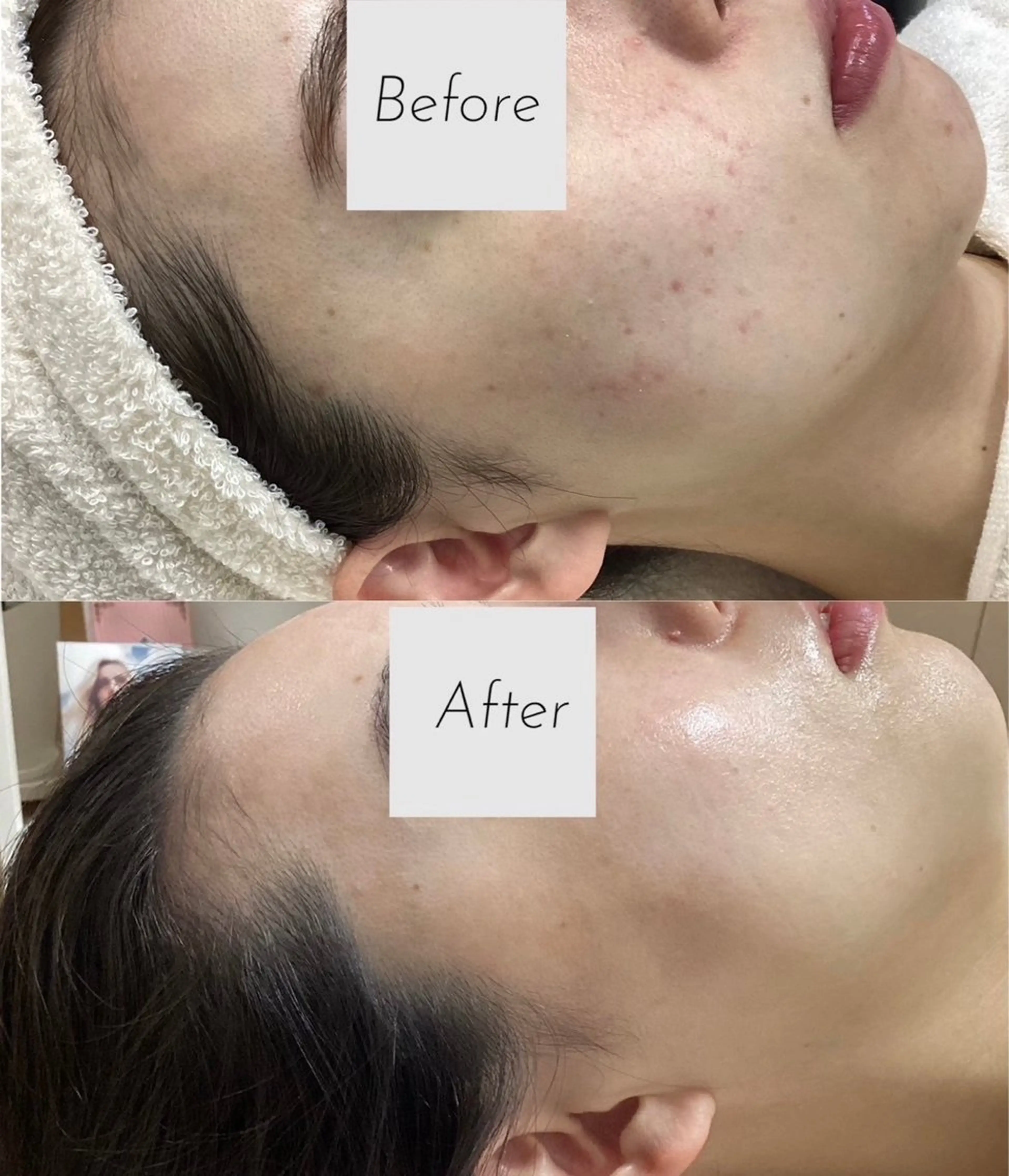 エステ 都度払い 肌質改善専門サロンのエステ・リラクイメージ