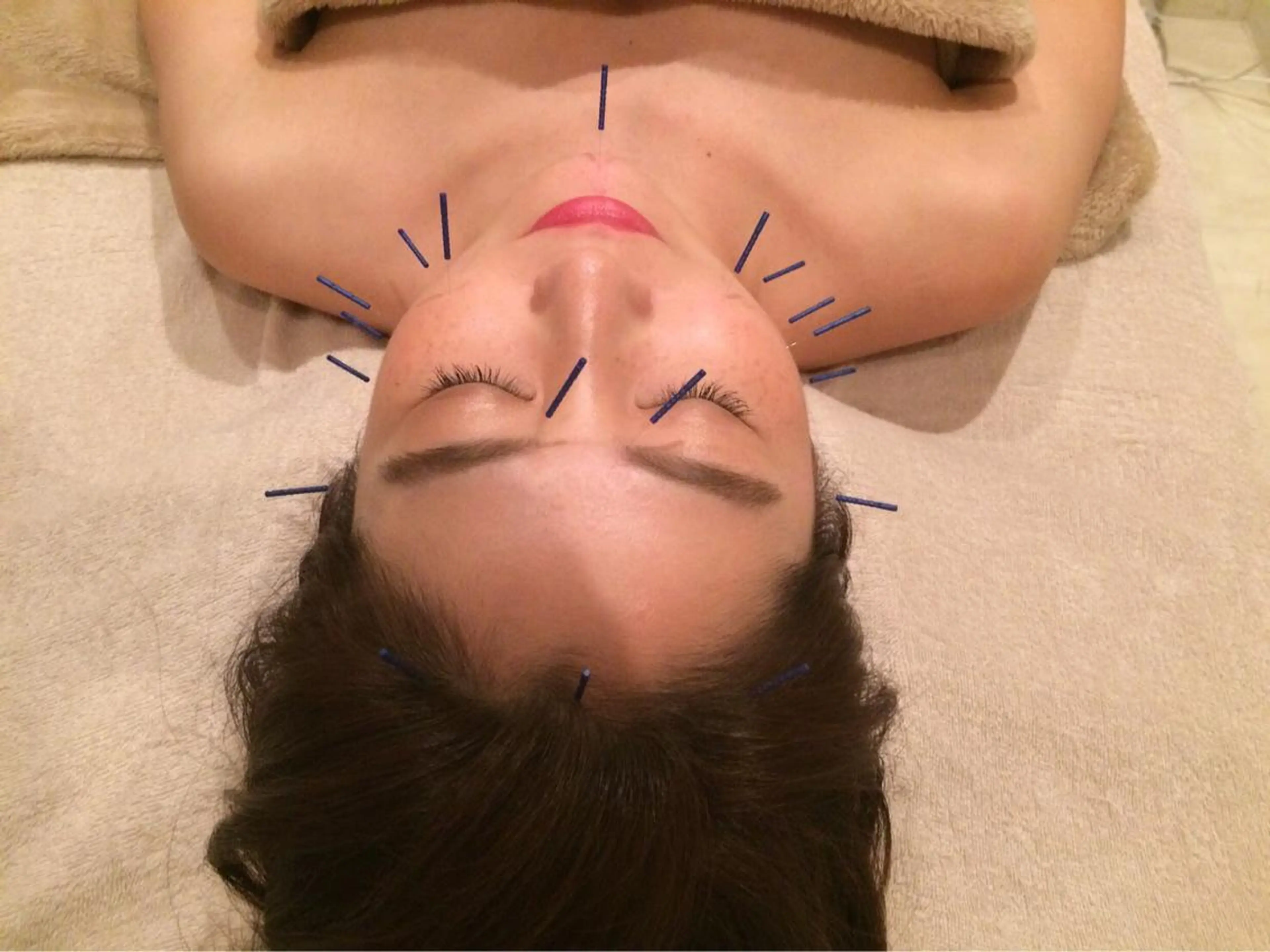 美容鍼サロン    Fleurir所属・伊藤 かなえのエステ・リラクイメージ