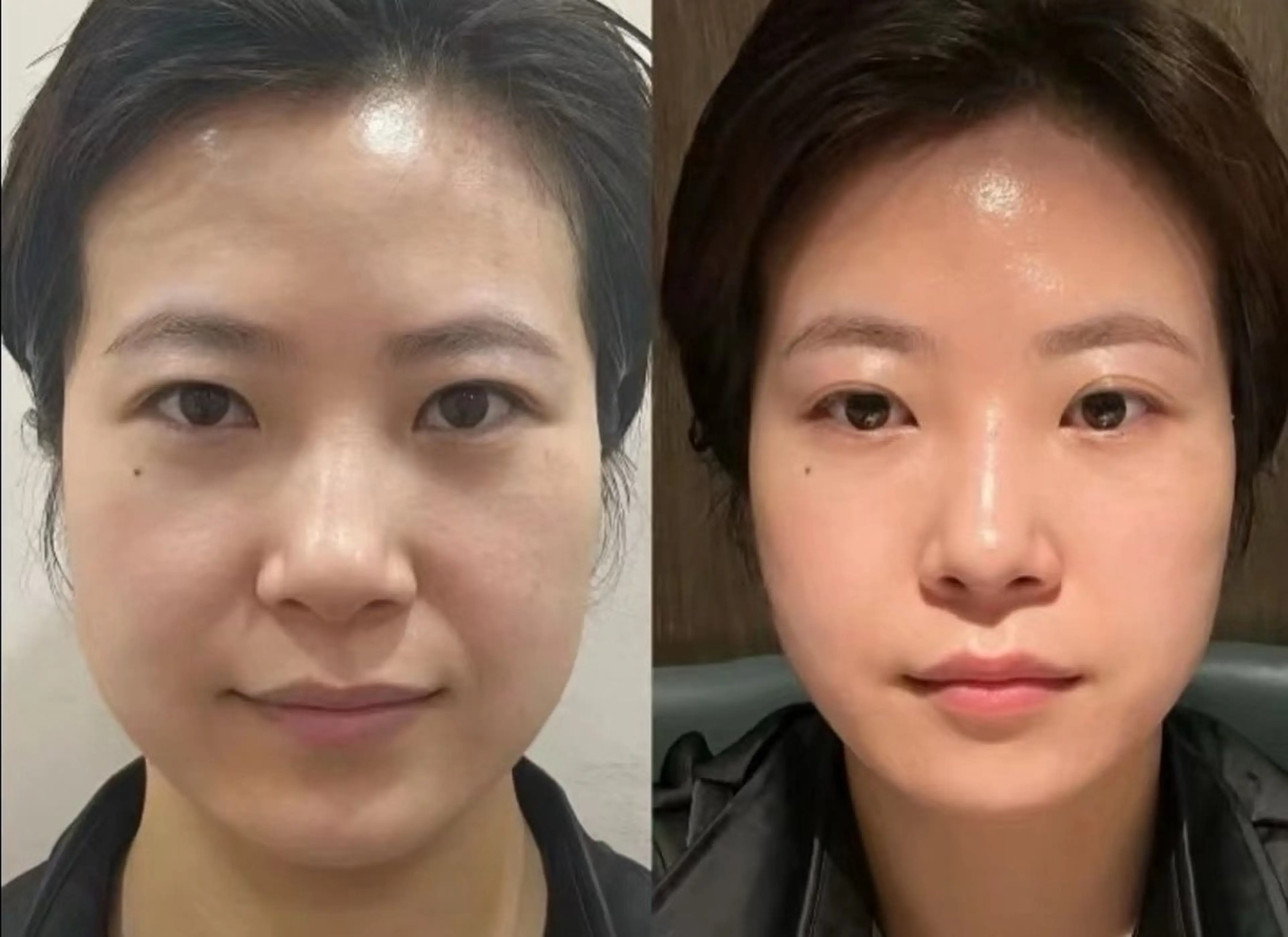 ショート エステ aliaハイフ&水光ジェットサロン所属・aliaハーブ水光店 エステティシャン募集のエステ・リラクイメージ