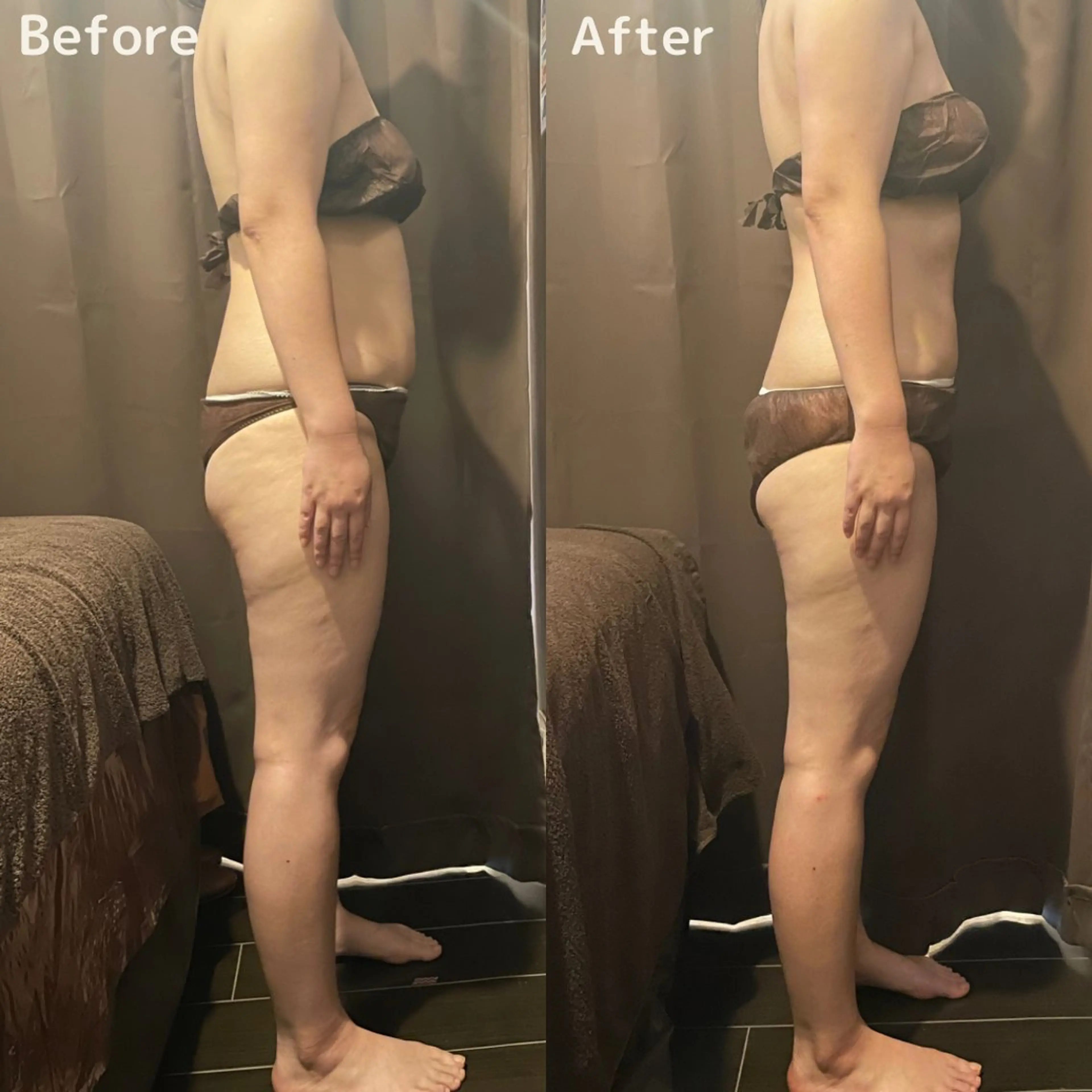 エステ 痩身・フェイシャル/if byOrabriller所属・if byOrab riller【イフ】のその他イメージ