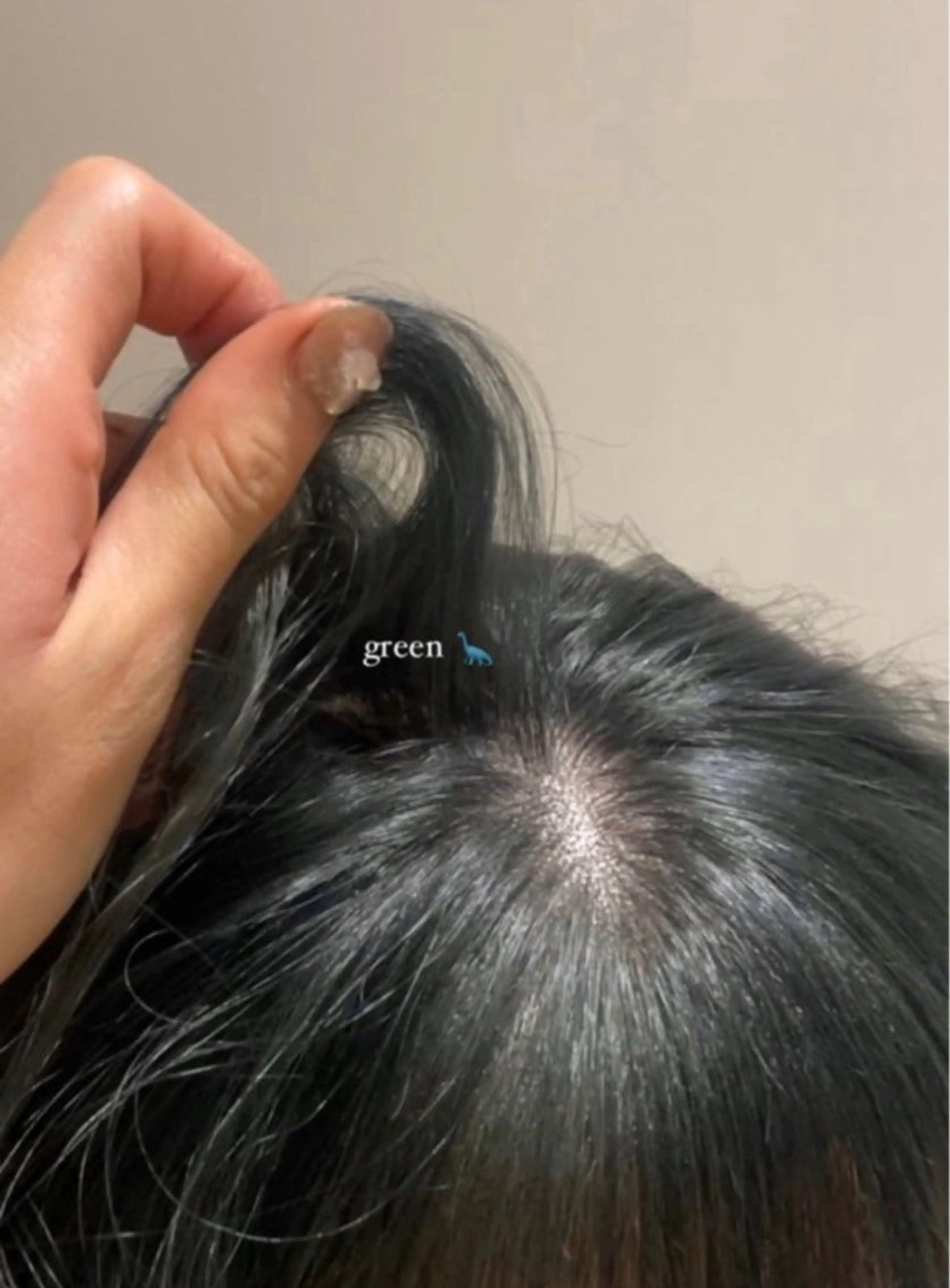 《 12月限定 》ブリーチリタッチ＋カラー＋プレミアムトリートメント🎀の写真