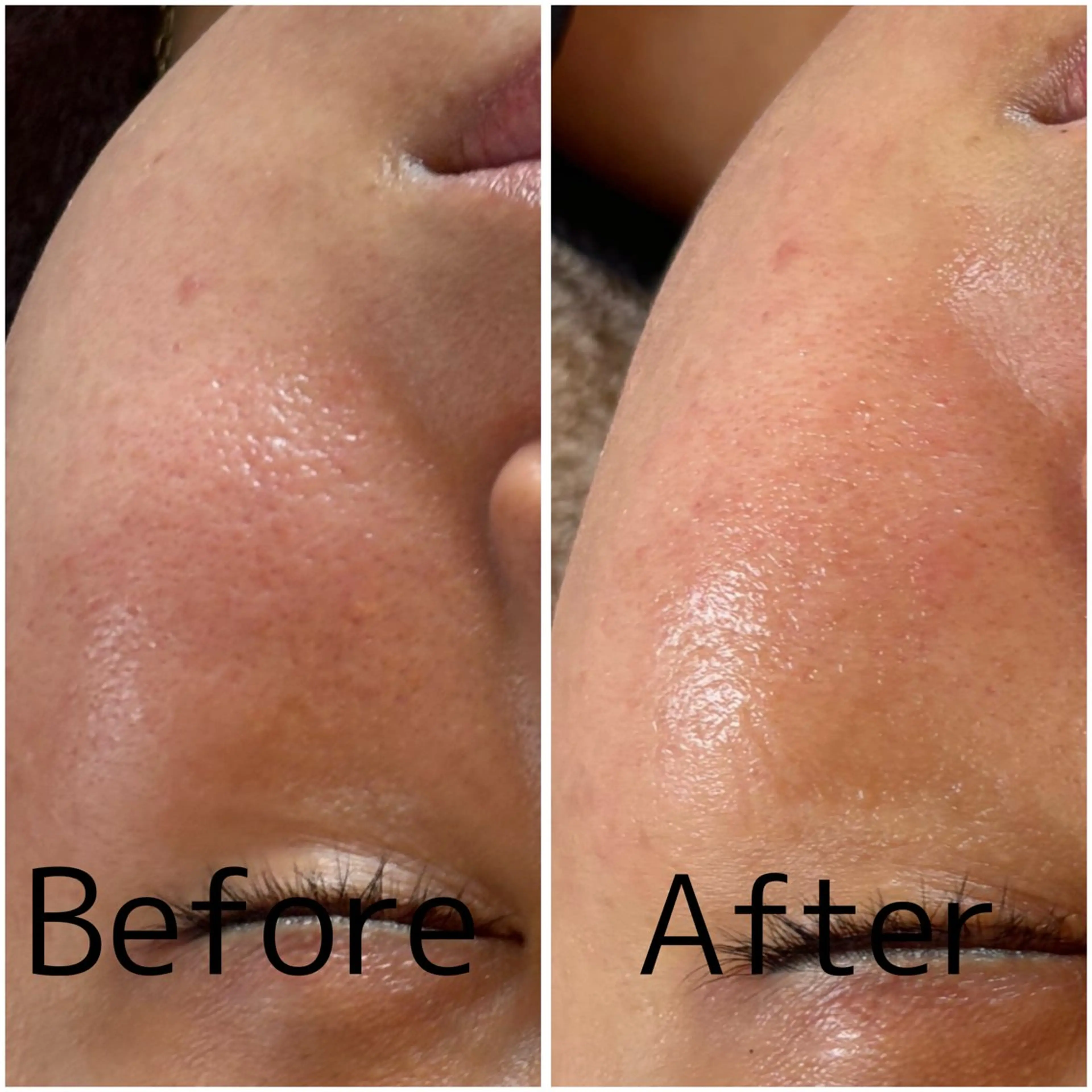 エステ 【敏感肌管理×小顔サロン】Belle orchid所属・東三国/新大阪 敏感肌×小顔サロンのエステ・リラクイメージ