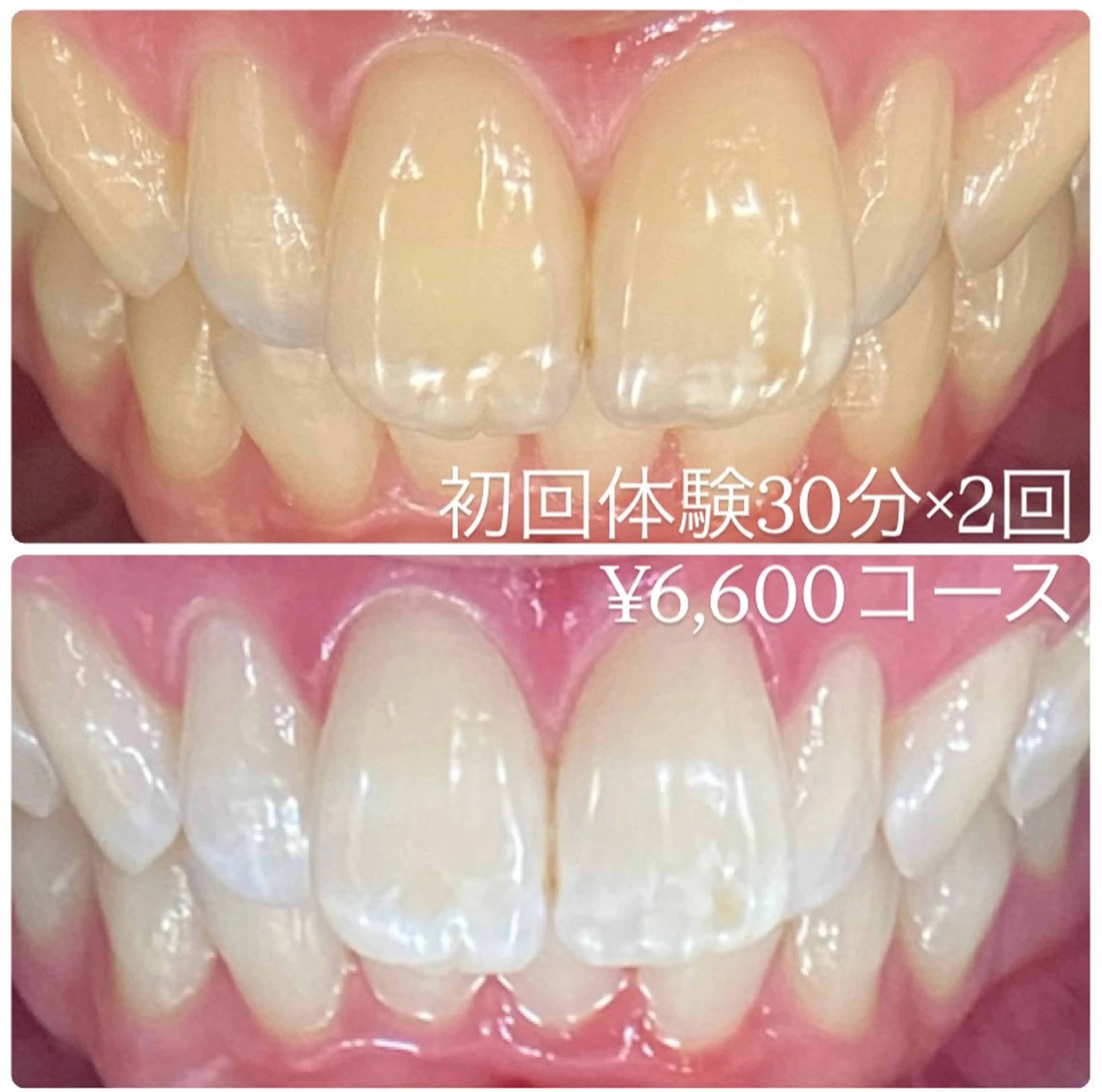 PLATINUM Beauty 横浜店所属・ホワイトニングルーム 横浜店のその他イメージ