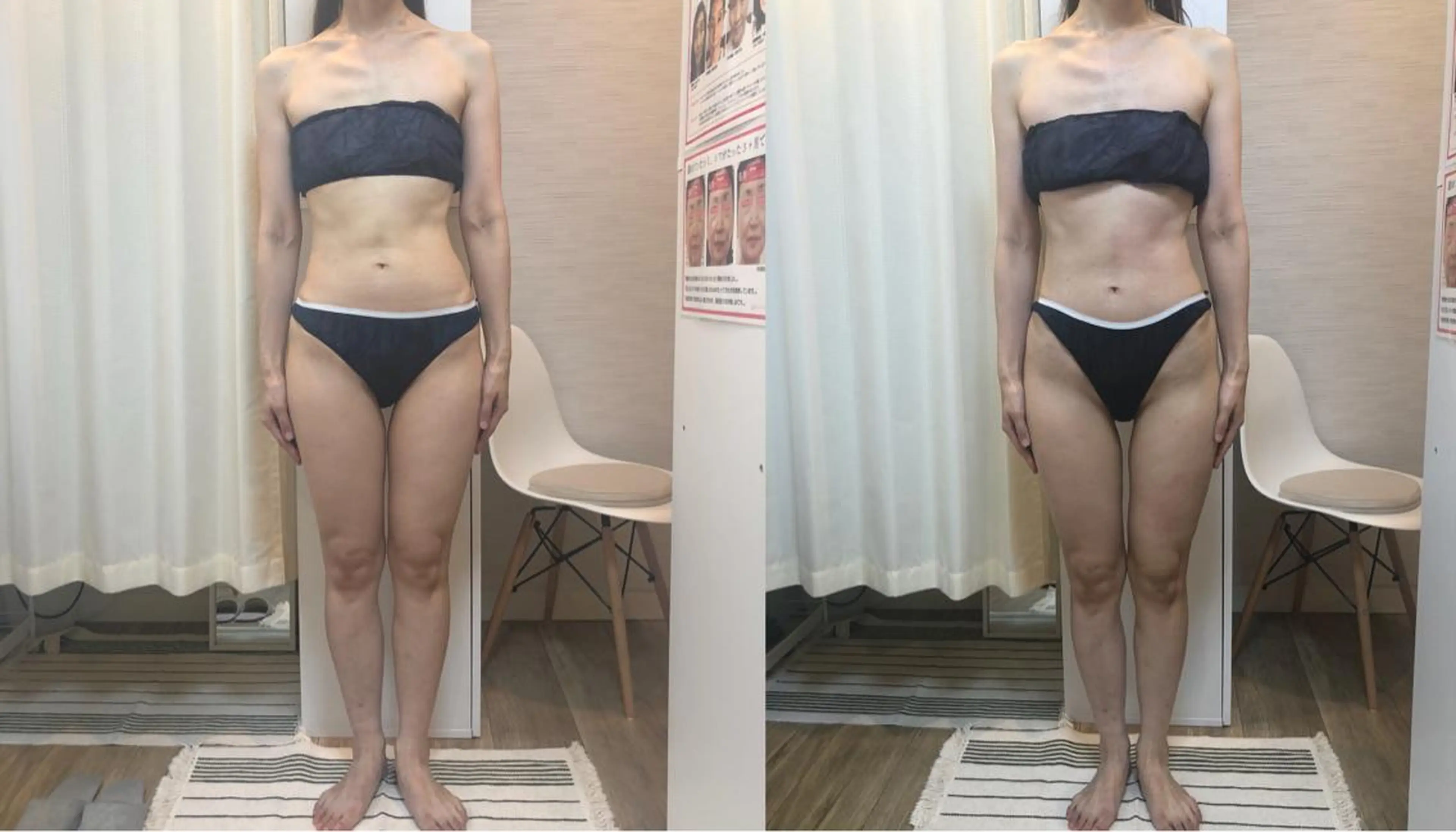 エステ 脱毛｜ピーリング ROOM.Sのエステ・リラクイメージ