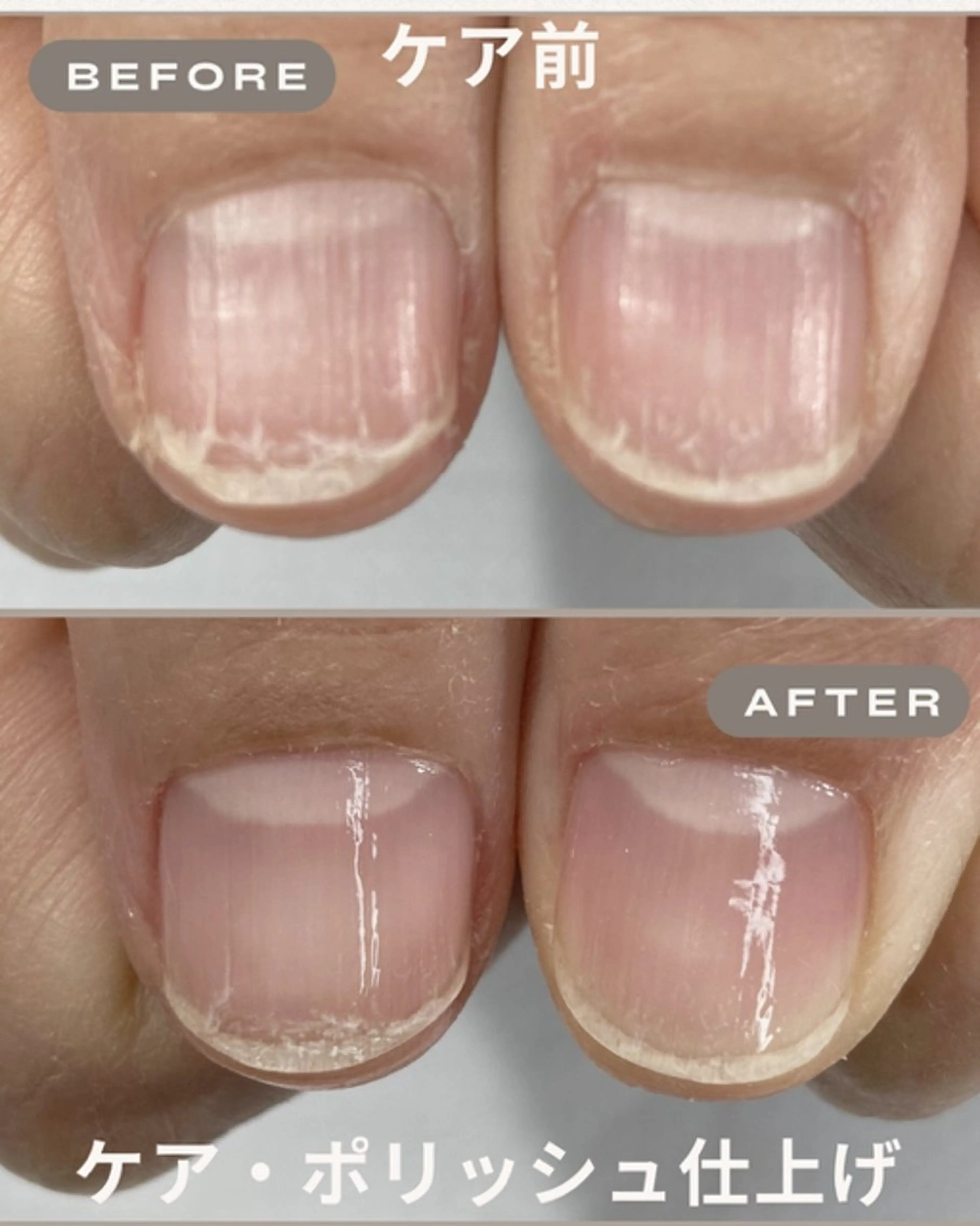 見違えるネイルケアモニターの写真