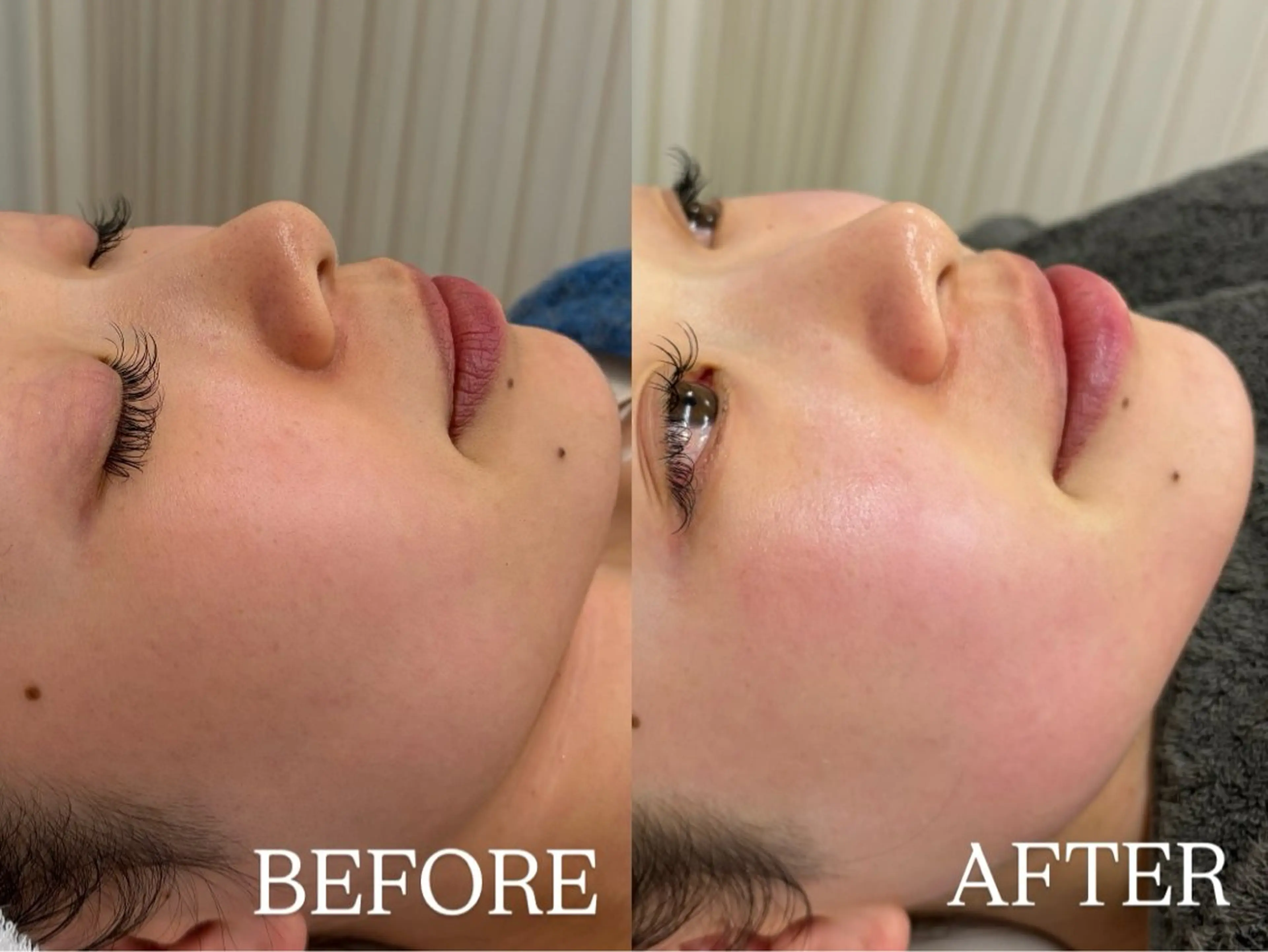 艶肌✨フェイシャルワックス🍯の写真