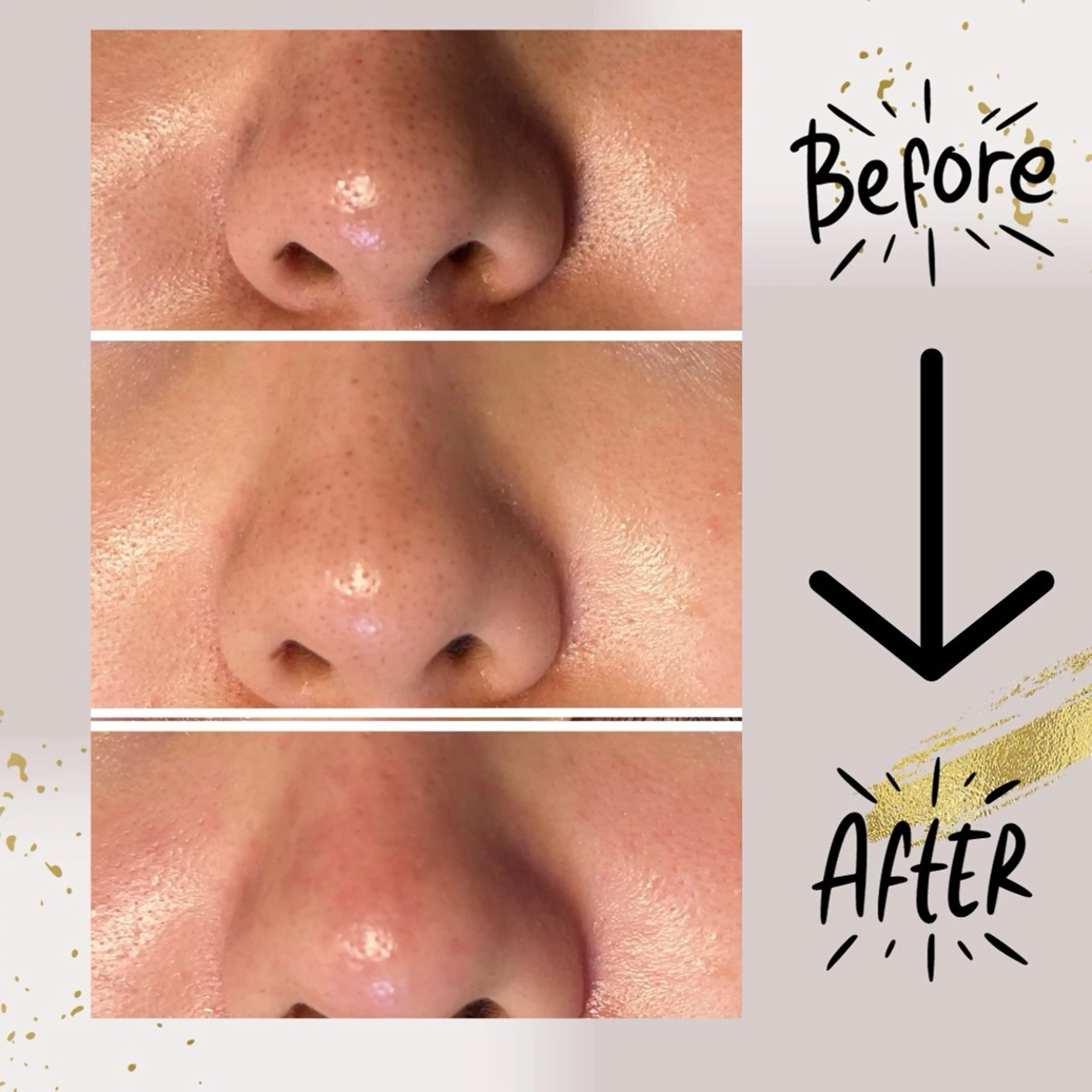 ピーリング専門店 Belluteのエステ・リラクイメージ