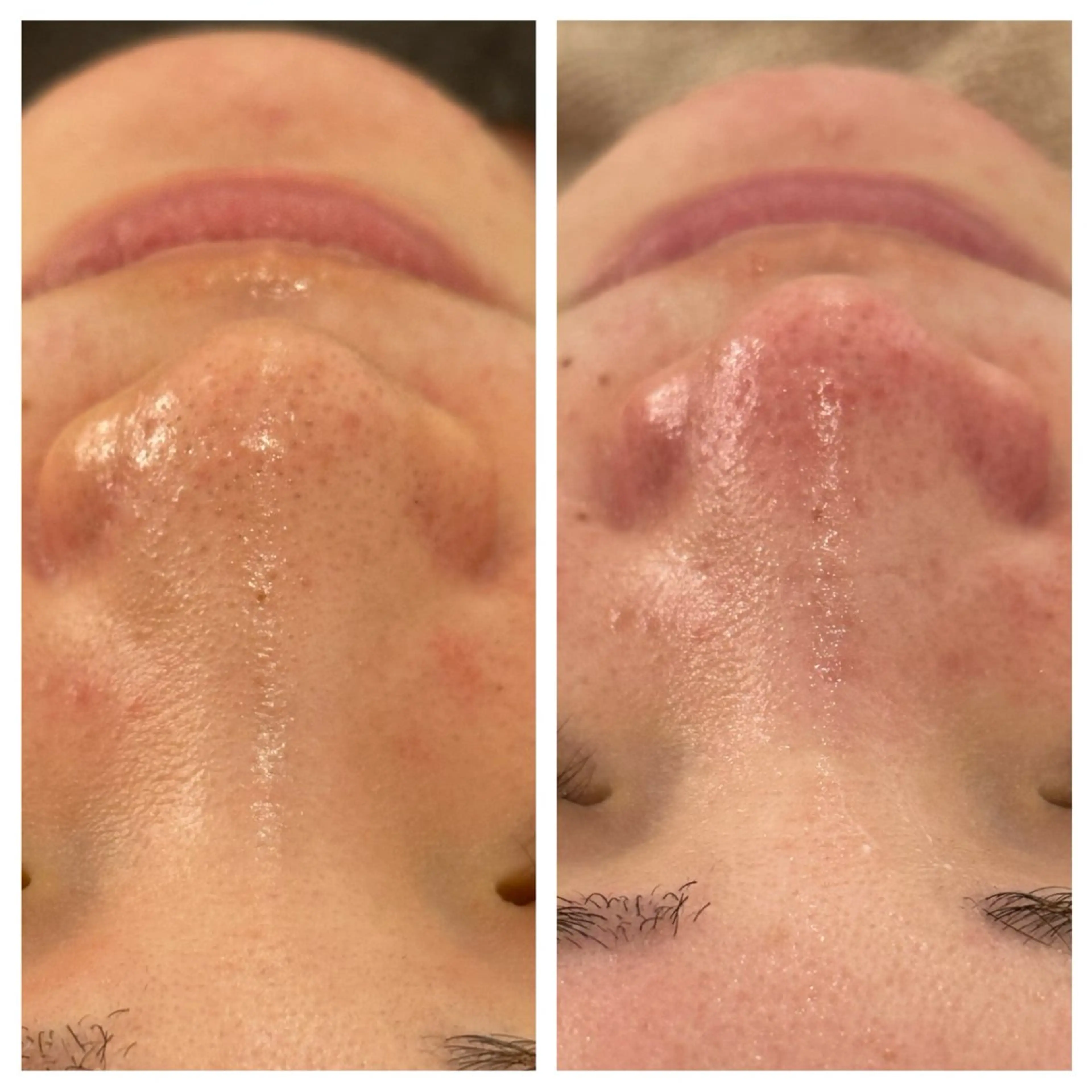 エステ リラク ANERA Second所属・尾上 沙織のエステ・リラクイメージ