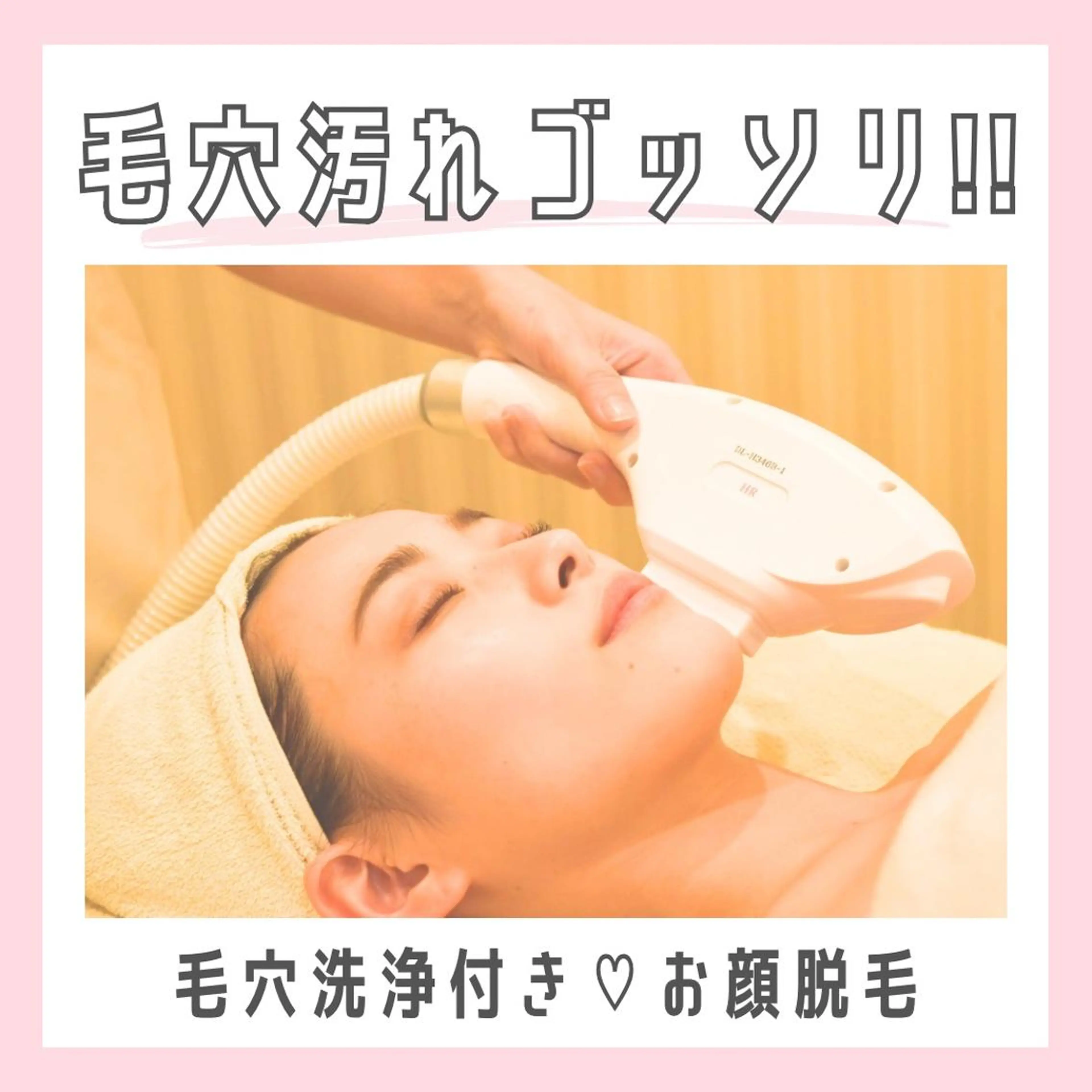 【初回限定】いちご鼻とはもうおさらば🍓毛穴洗浄付きお顔脱毛体験の写真