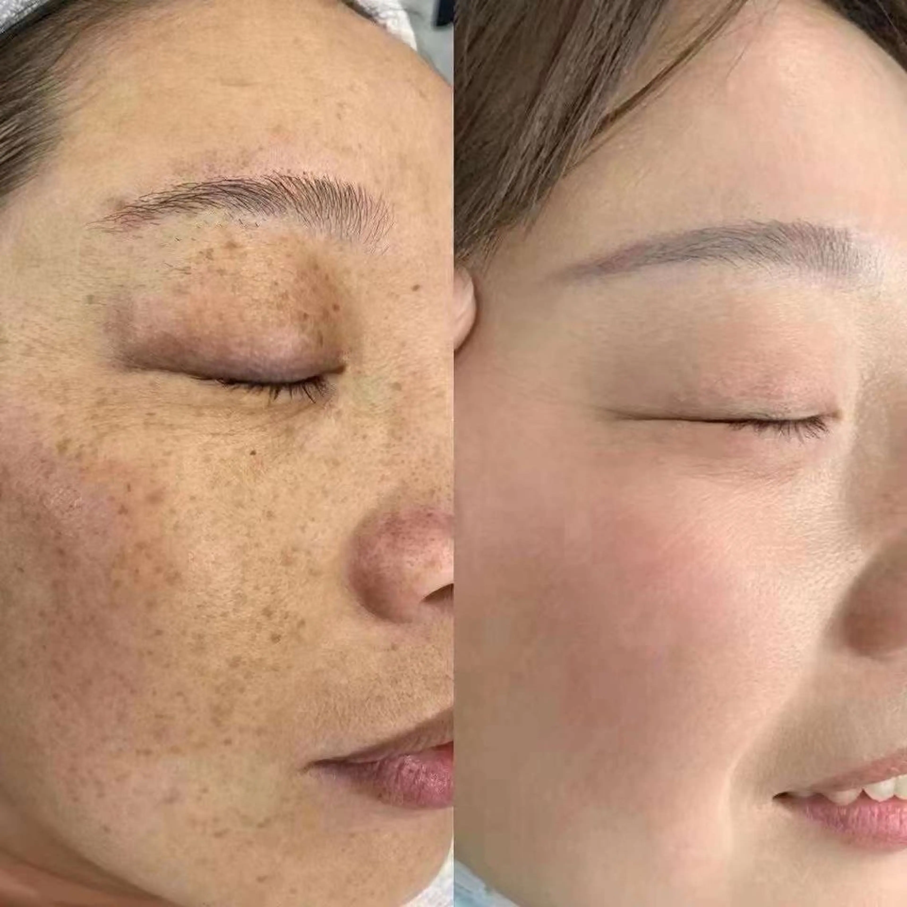 エステ エイナミ肌質改善 小顔痩身サロンのエステ・リラクイメージ