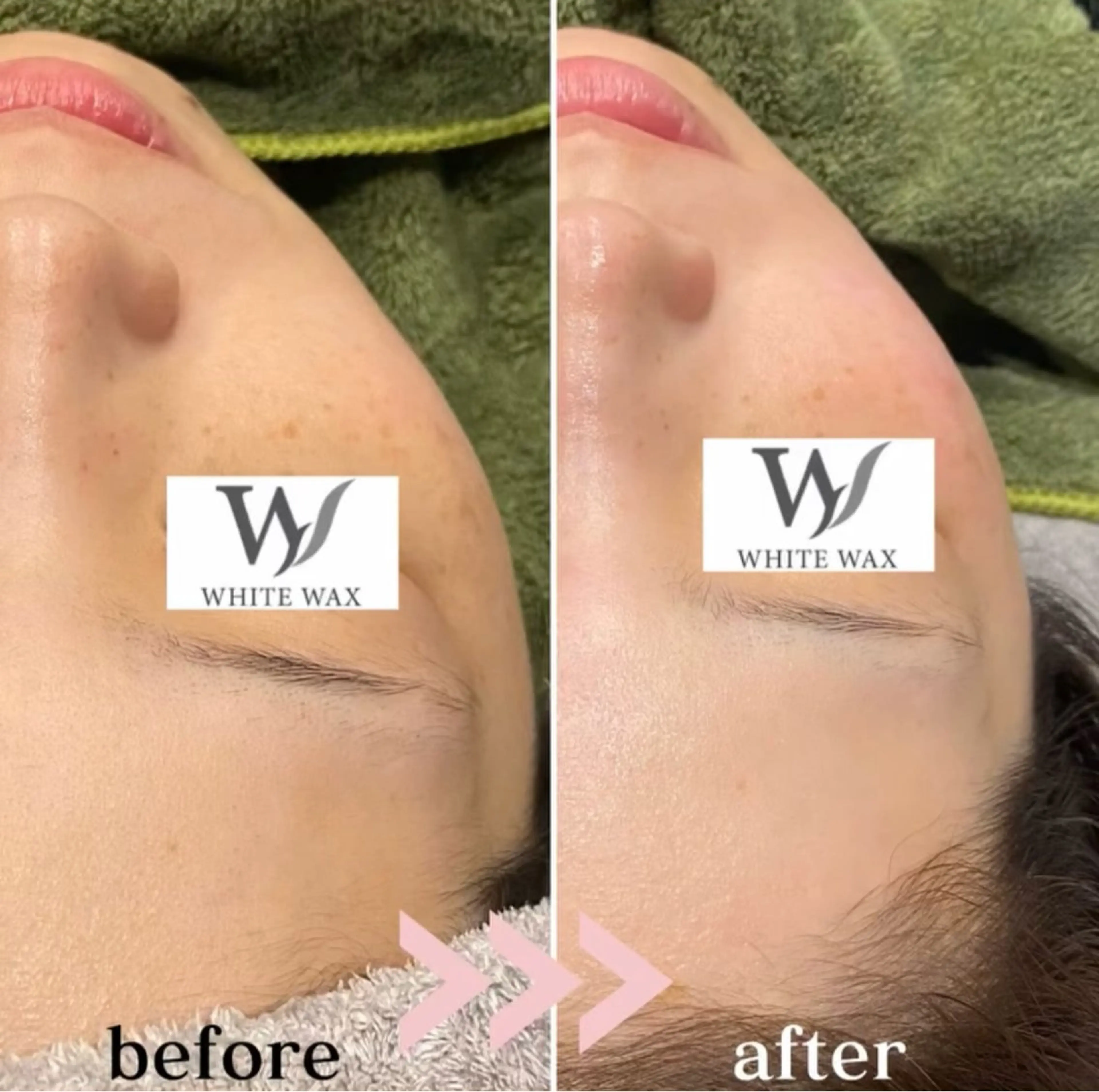 フェイシャルワックス(全顔)の写真