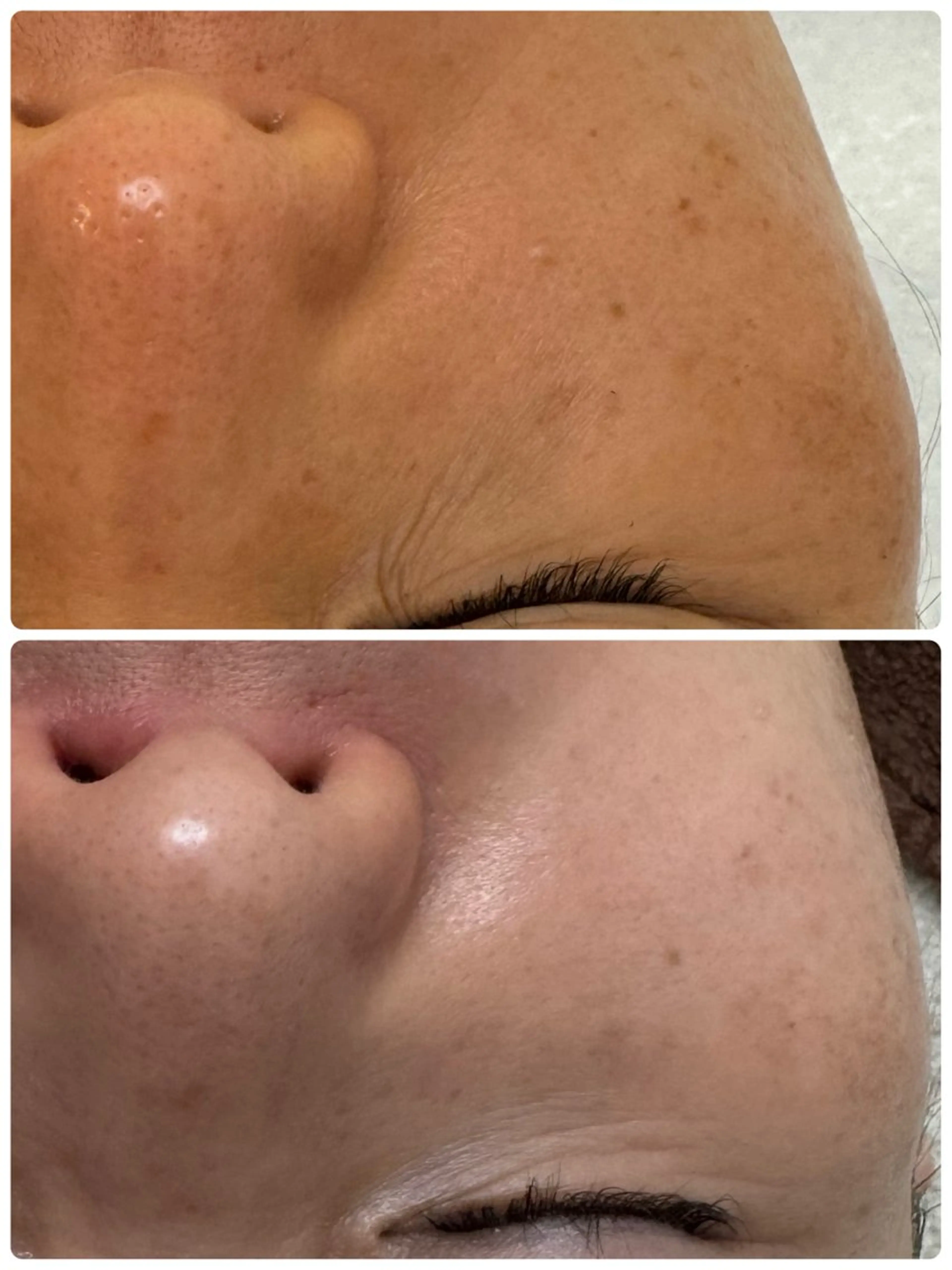 エステ リラク シミ毛穴専門店 yucca(ユッカ)のエステ・リラクイメージ