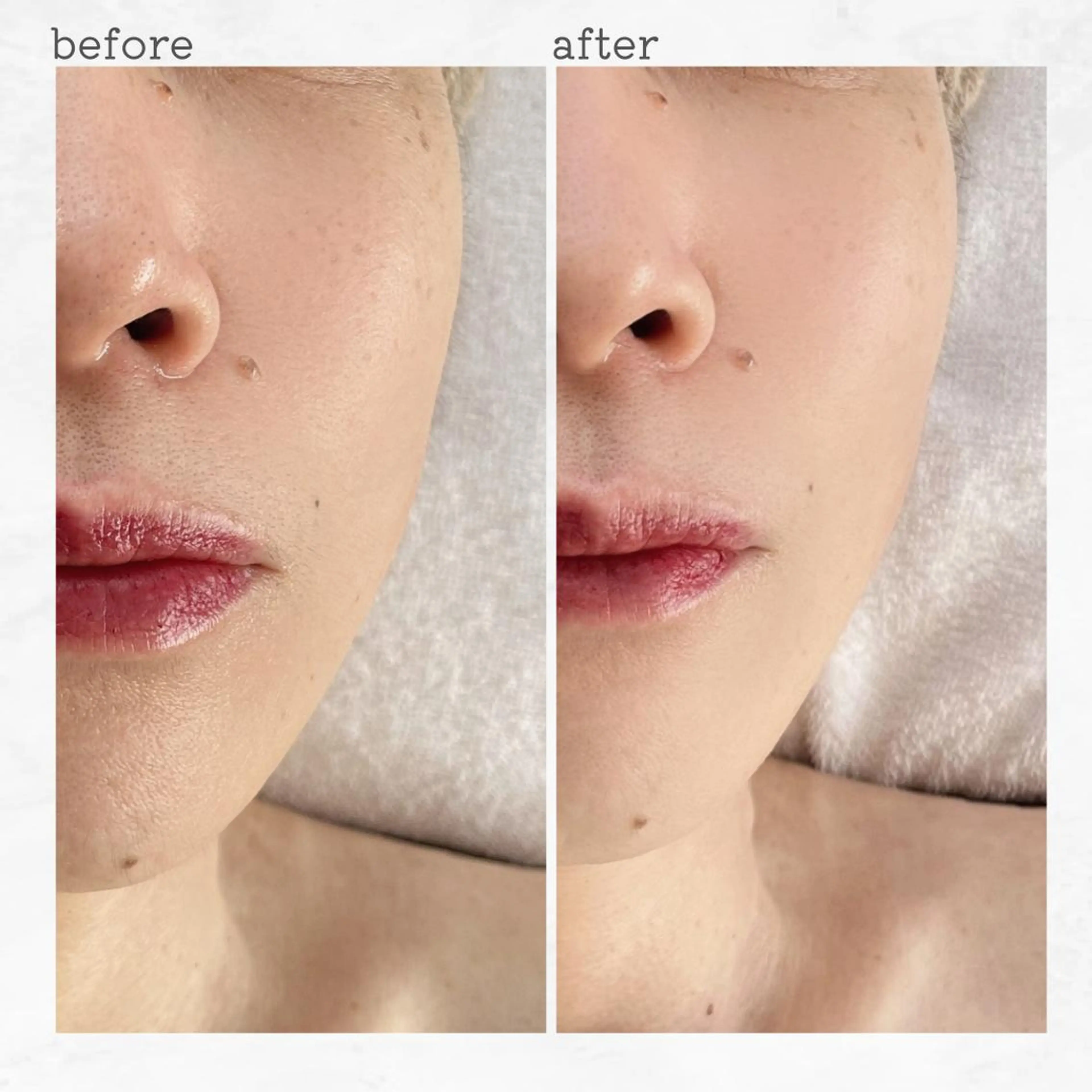 エステ 眉とお肌の専門サロン RioL / Aiのエステ・リラクイメージ