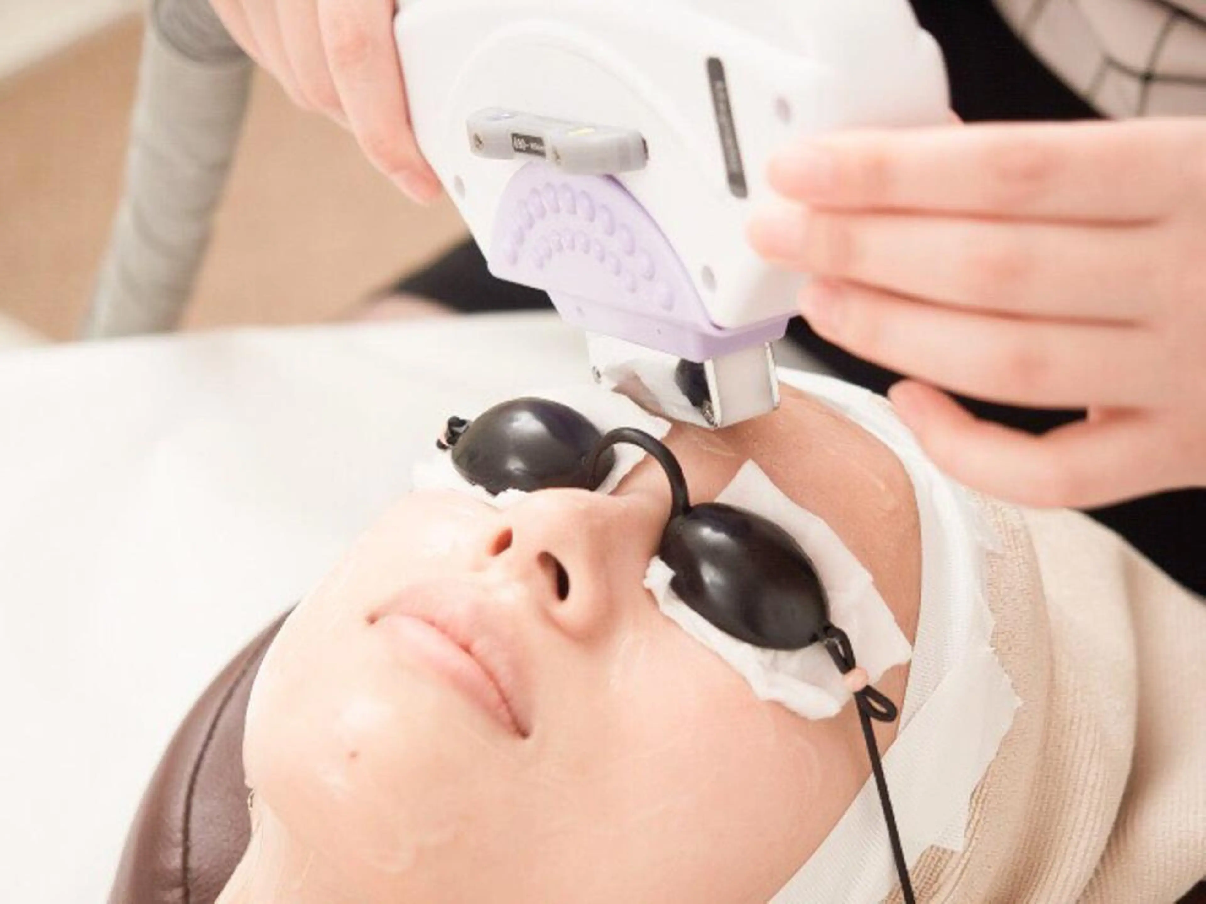 【フォト光フェイシャル+シェービング+保湿うるつやパック付★】シミ、毛穴、たるみ、美白に👊★の写真