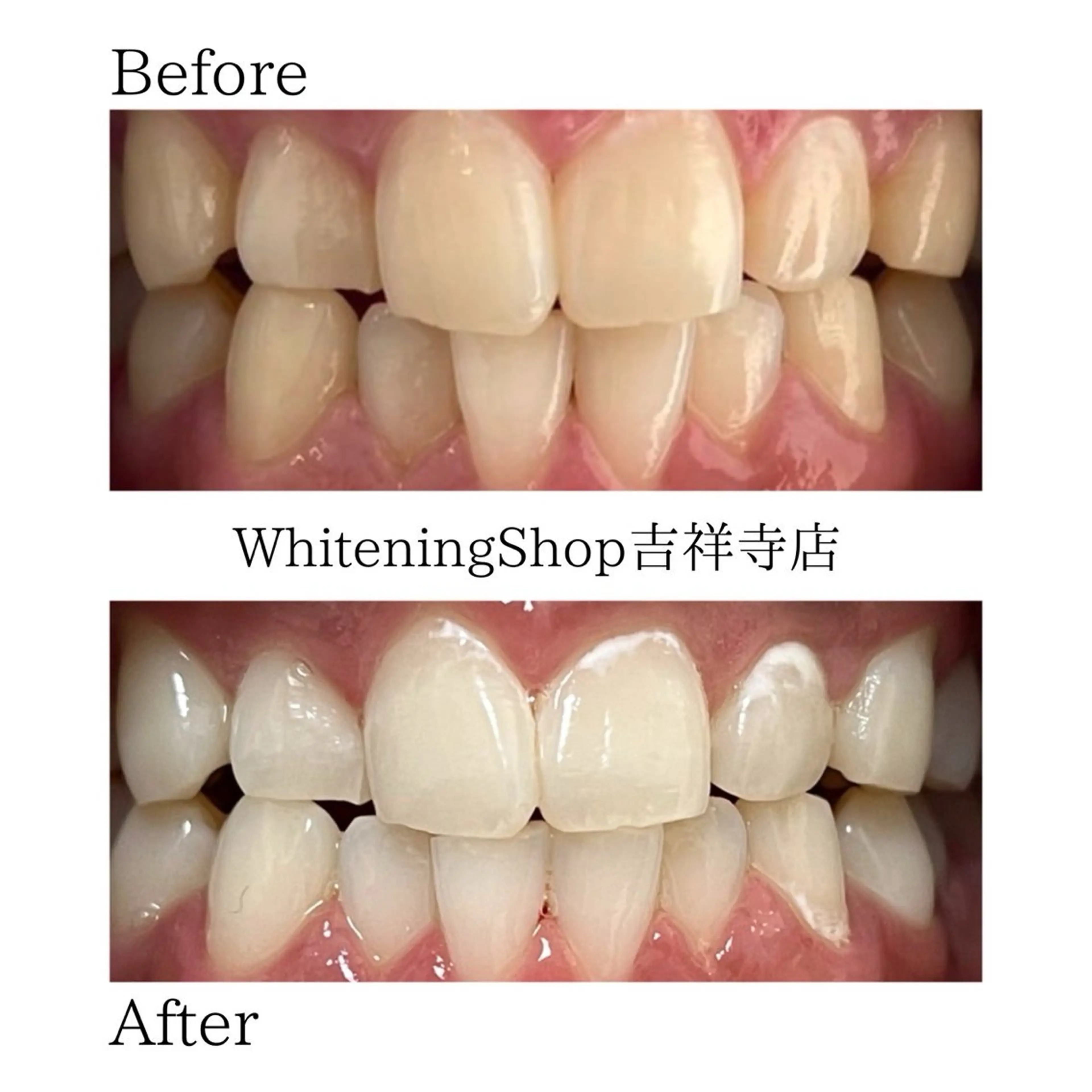 エステ リラク ホワイトニング ショップ吉祥寺店のエステ・リラクイメージ