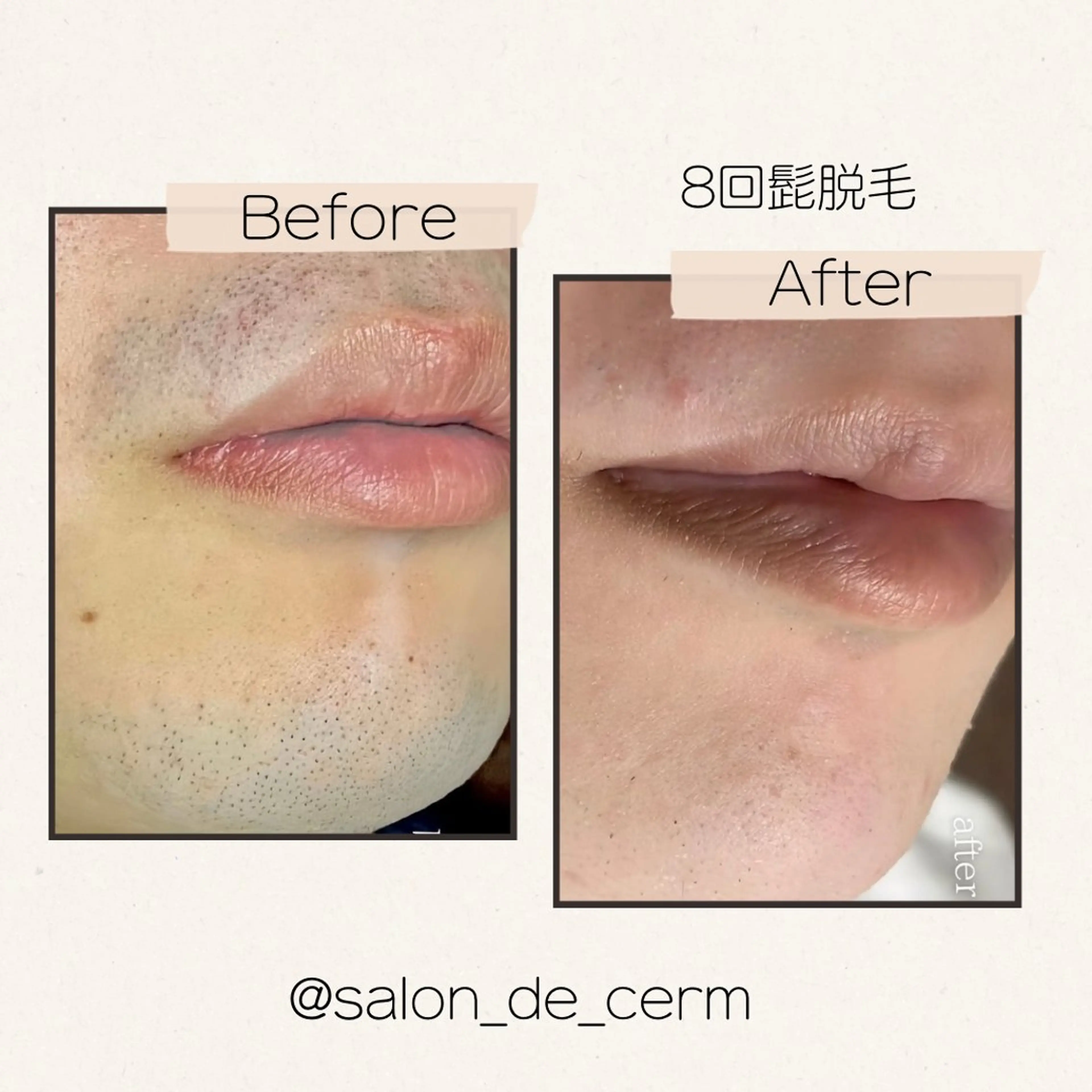 メンズ 脱毛 salon de cerm所属・CERM/心斎橋眉毛 /心斎橋HBLの眉毛・アイブロウイメージ